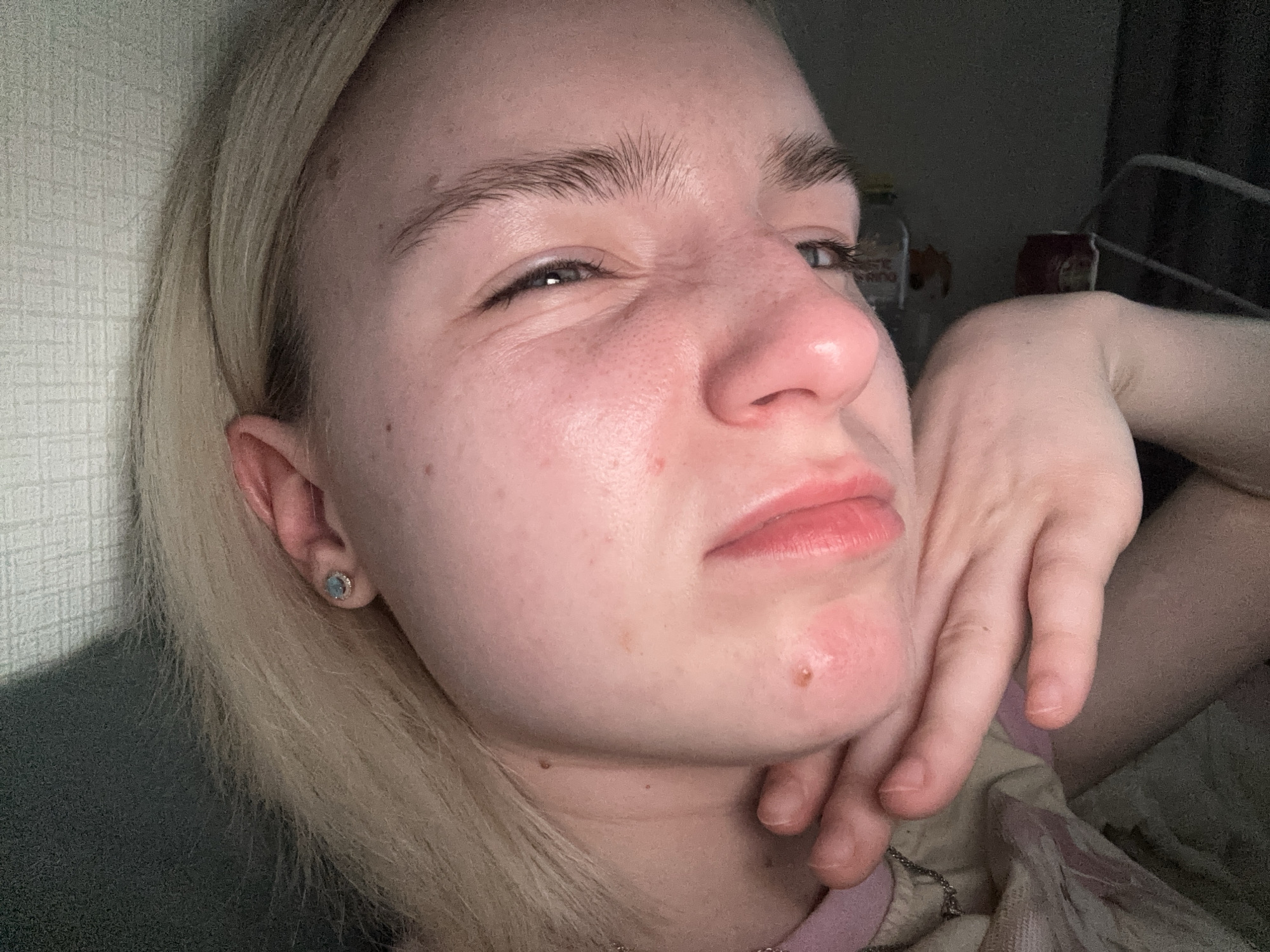 A close-up shot depicts a blonde-haired person with visible skin imperfections such as pores, wrinkles near the eyes, and a prominent blemish on their chin. They are making a slightly skeptical or disapproving facial expression. The person's left hand is positioned near their face. An earring is visible in the left ear. In the background, a wall is seen, along with some indistinct objects like bottles and a can. The setting appears to be indoors. Location: Unknown, Unknown.