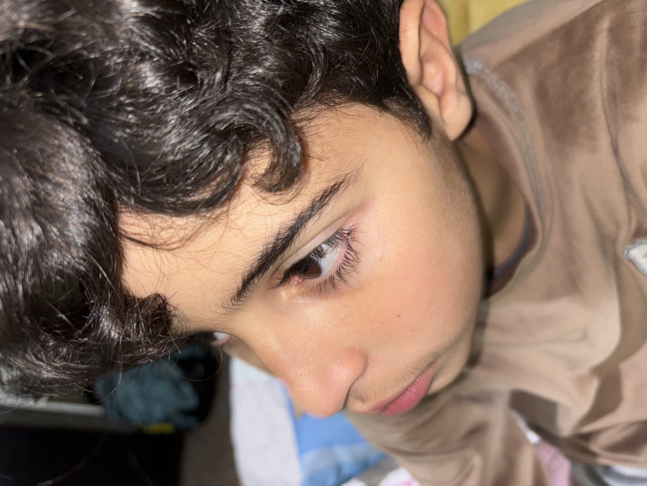 A young person's face dominates the frame, angled slightly downward. Dark, curly hair contrasts with smooth skin. A focused gaze emanates from a brown eye. Details include visible eyelashes and light facial hair above the lip. The person wears a tan-colored garment. A hint of bedding and other objects appear blurred in the background.