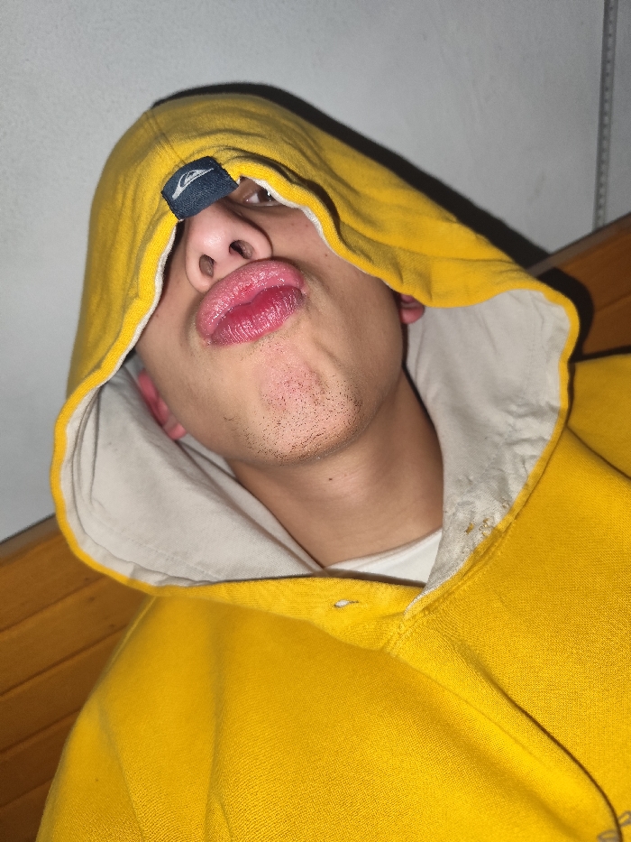 A person wearing a yellow hooded sweatshirt puckers their lips towards the camera. The hood is lined with a white material. A dark label with a light-colored logo is visible on the front of the hood, partially covering the nose. The background appears to be a wall. The person's face is the primary focus, showing only a portion of their neck and upper chest.