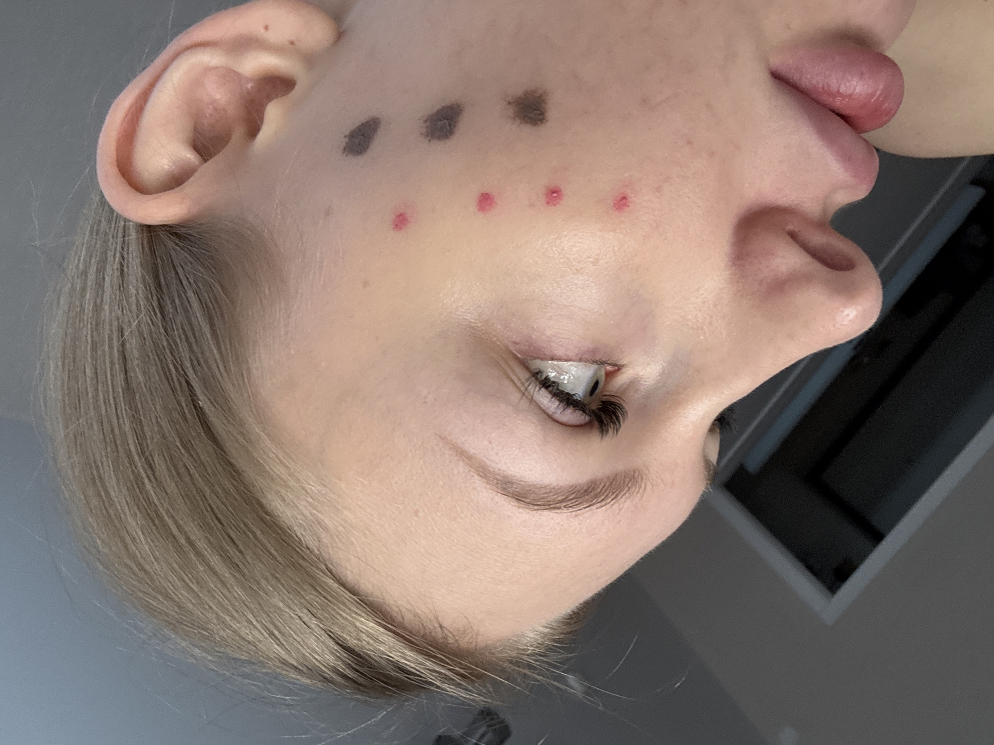 A close-up image of a woman's face, rotated so that her left ear is at the top left of the frame. She has fair skin and blonde hair. There are four dark spots and four red dots marked on her left cheek. Her left eye is open, with long eyelashes. Her lips are slightly parted.
The location in the city of Perm, Russia is not discernable from the provided image.