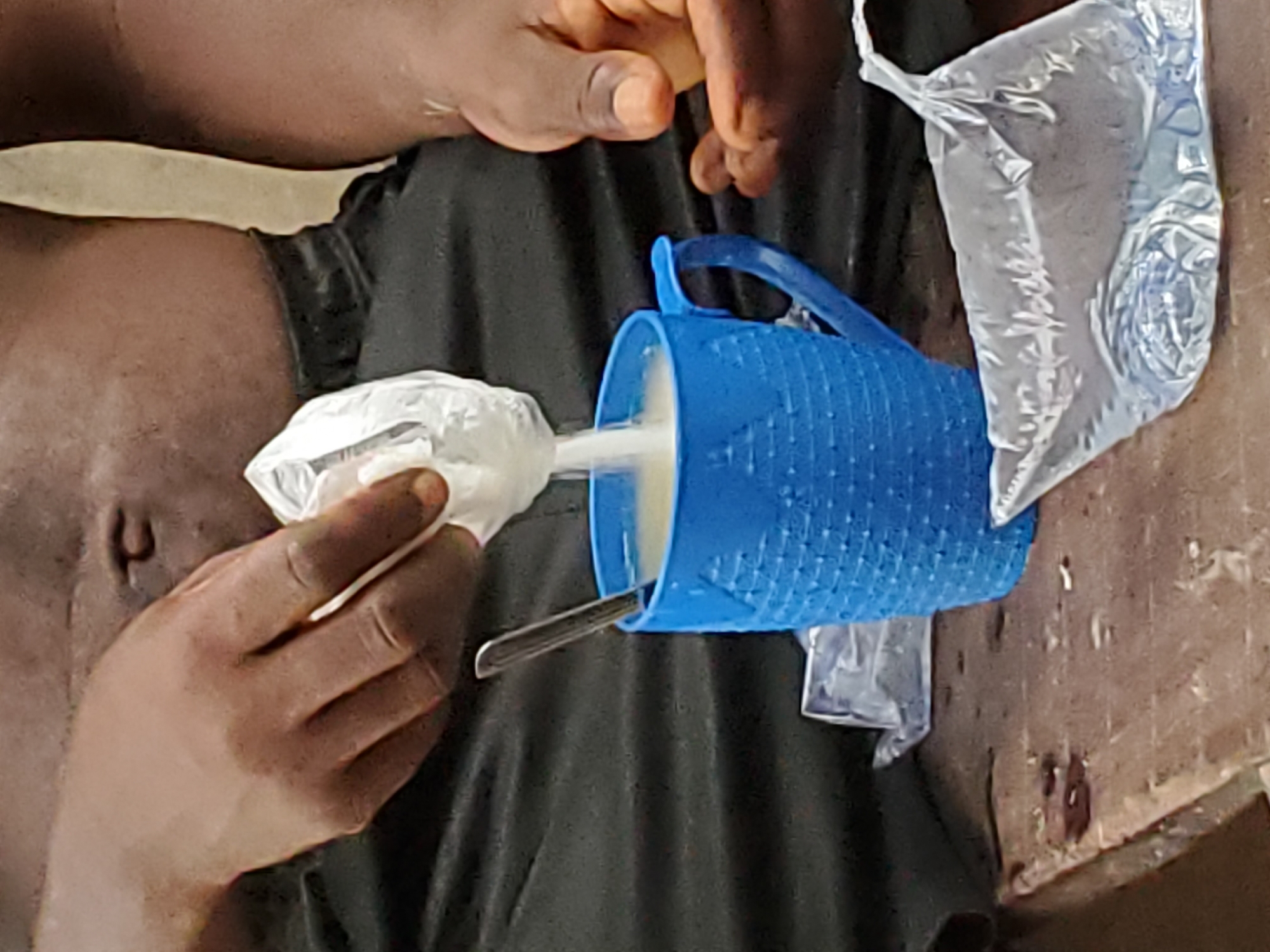 In a close-up, high-angle shot, a person with dark skin is seen preparing a drink or food item. The upper part of their torso and hands are visible. The person is wearing dark-colored clothing or has a dark fabric covering their lap, and a lighter-colored strip of material is visible across their midsection.
The main activity involves the person squeezing a small, clear plastic sachet, which contains a white or light-colored liquid, into a blue plastic mug. The mug has a textured, grid-like pattern and a handle. A metallic spoon rests inside the mug. To the right of the mug, another, larger clear plastic sachet, also containing a liquid or semi-liquid substance, is visible, resting on a rough, brownish surface that appears to be wood or a similar material.
The person's right hand is gripping and squeezing the small sachet, while their left hand is partially visible near the mug. The exposed abdomen of the person shows their navel. The hands appear to have some dirt or discoloration, possibly from the surrounding environment or the contents being handled. The scene depicts a casual preparation of a beverage or meal, likely in a domestic or informal setting. No specific time of day or weather conditions can be determined from the lighting. There is no visible text in the image.