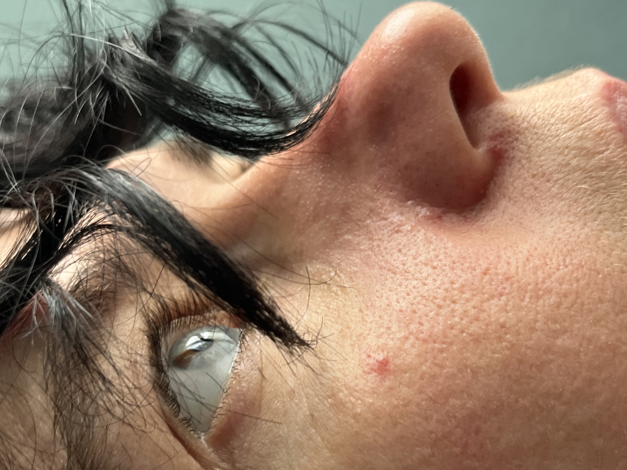 The image is a close-up, side profile of a person's face, focusing on the eye and nose area. The skin appears to have visible pores and some redness, with a small red mark on the cheek. Dark hair, some with grey strands, falls across the face. The background is a solid, light blue-green color. There are no visible city landmarks or elements that would indicate a specific location within ღრმაღელის თემი, Georgia.