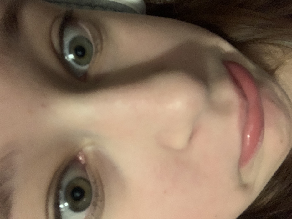 A close-up, tilted view of a person's face. Two wide eyes with green irises are prominent. The skin is fair with slight blemishes. A nose is centered in the frame, and part of a mouth is visible, featuring full, glossy lips. Some hair is apparent along the edge of the frame.