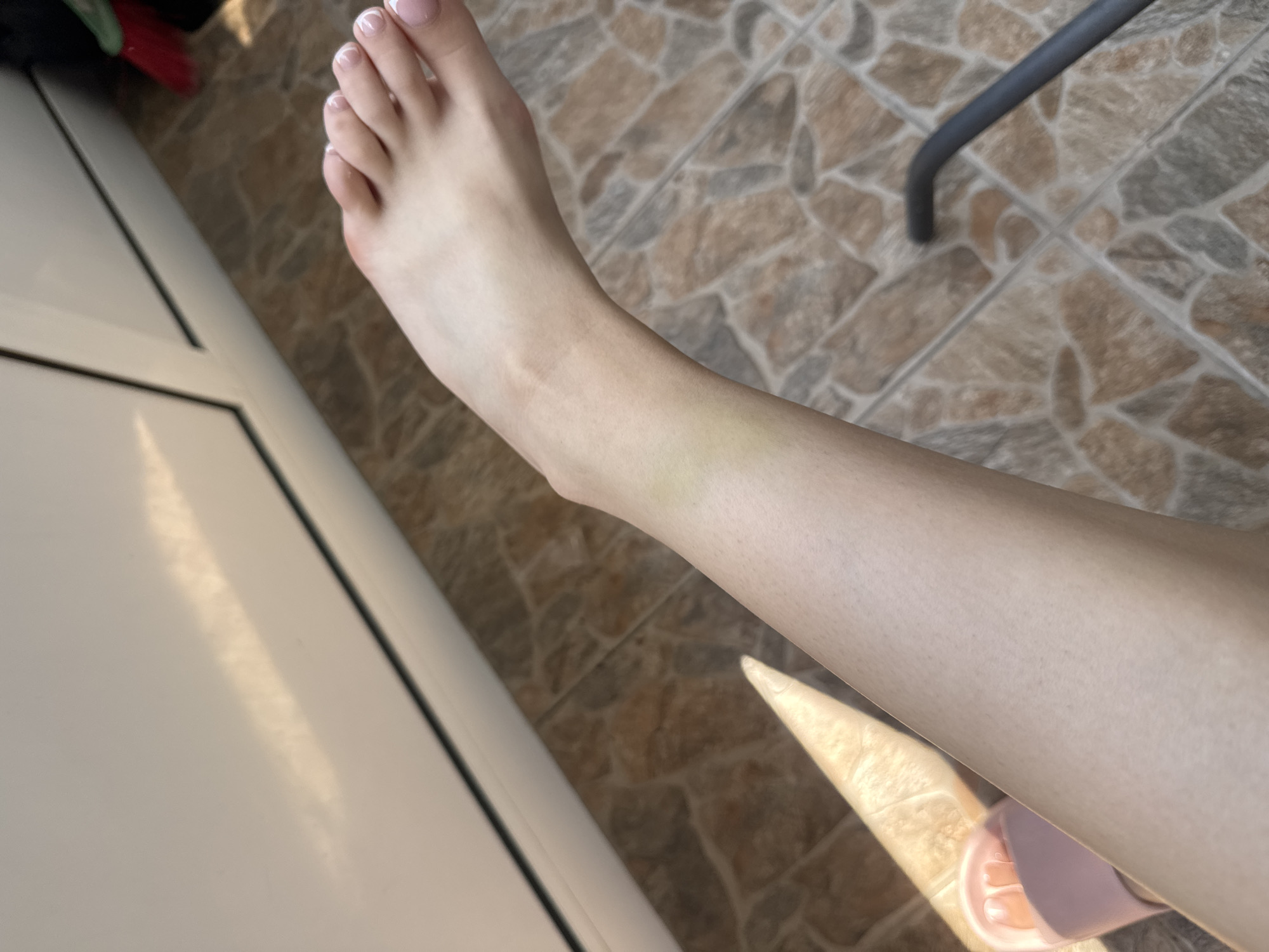 The image presents a downward-angled view of a person's bare lower leg and foot in an indoor setting. The leg and foot are positioned centrally, extending diagonally from the lower left to the upper right. The skin is light-toned, and a distinct yellowish-green discoloration, consistent with a healing bruise, is visible on the anterior aspect of the distal shin/ankle area. The toenails are neatly manicured with white tips. A portion of a pink, open-toed slide sandal is visible on the left foot, at the bottom-left edge of the frame.
The floor is covered with irregular, multi-toned ceramic tiles in shades of brown, grey, and terracotta, laid with visible light-colored grout lines. Along the left and top edges of the image, a white, smooth surface, possibly a wall or cabinetry, is present, featuring a distinct dark horizontal line. Strong, warm-toned light, indicative of sunlight, illuminates the scene from an unidentifiable source, creating a bright, triangular highlight on the floor and the lower part of the leg. In the upper right corner, a red brush head is partially visible. A dark, curved object, likely part of a furniture item, is present in the lower right background. The specific city of Plovdiv, Bulgaria, cannot be determined from the visual information provided in the image.