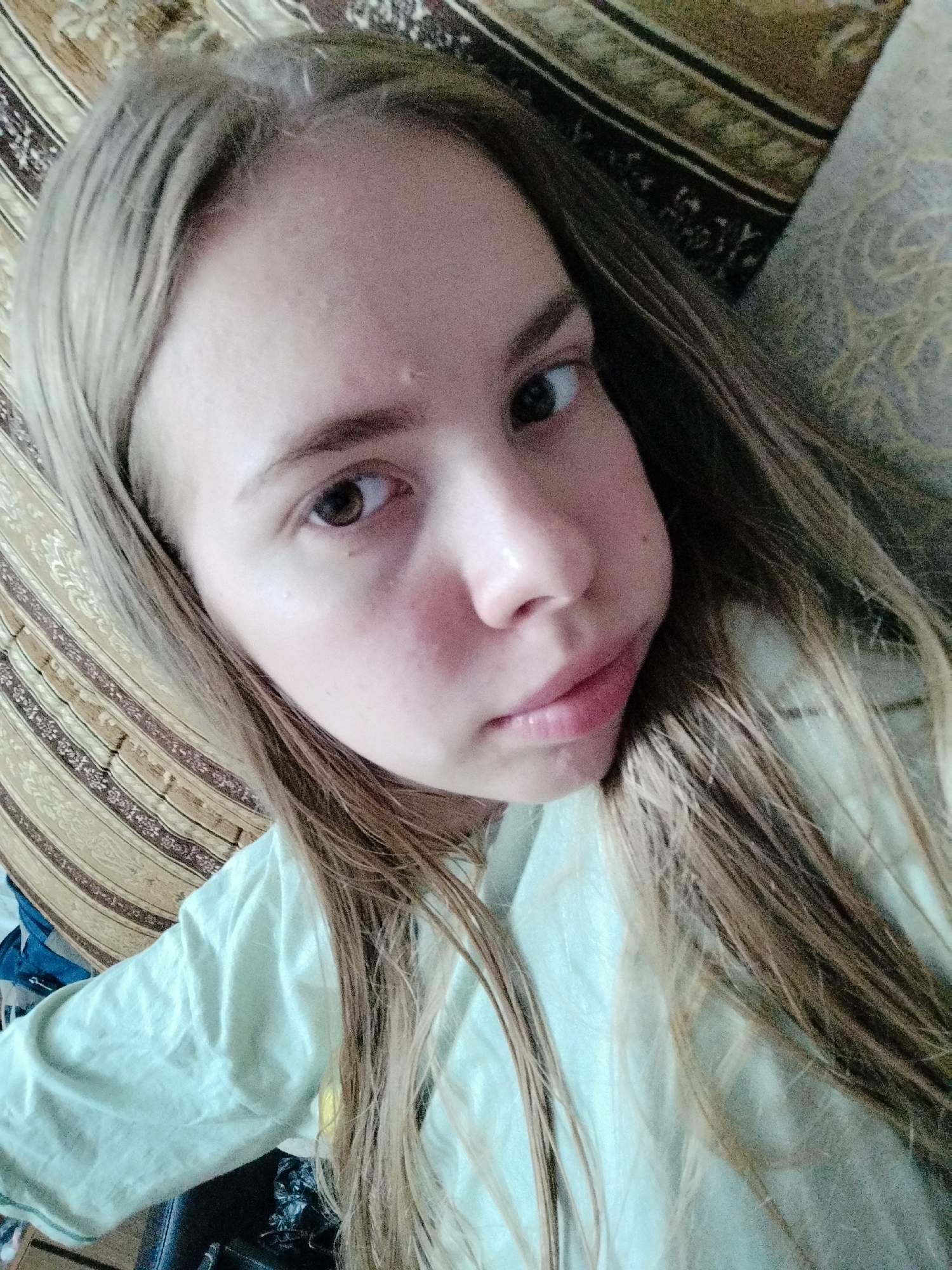 A young girl with long blonde hair is lying down and looking up at the camera. She is wearing a light green t-shirt. She is on a striped sofa. Her left cheek is swollen. The background is a striped sofa.