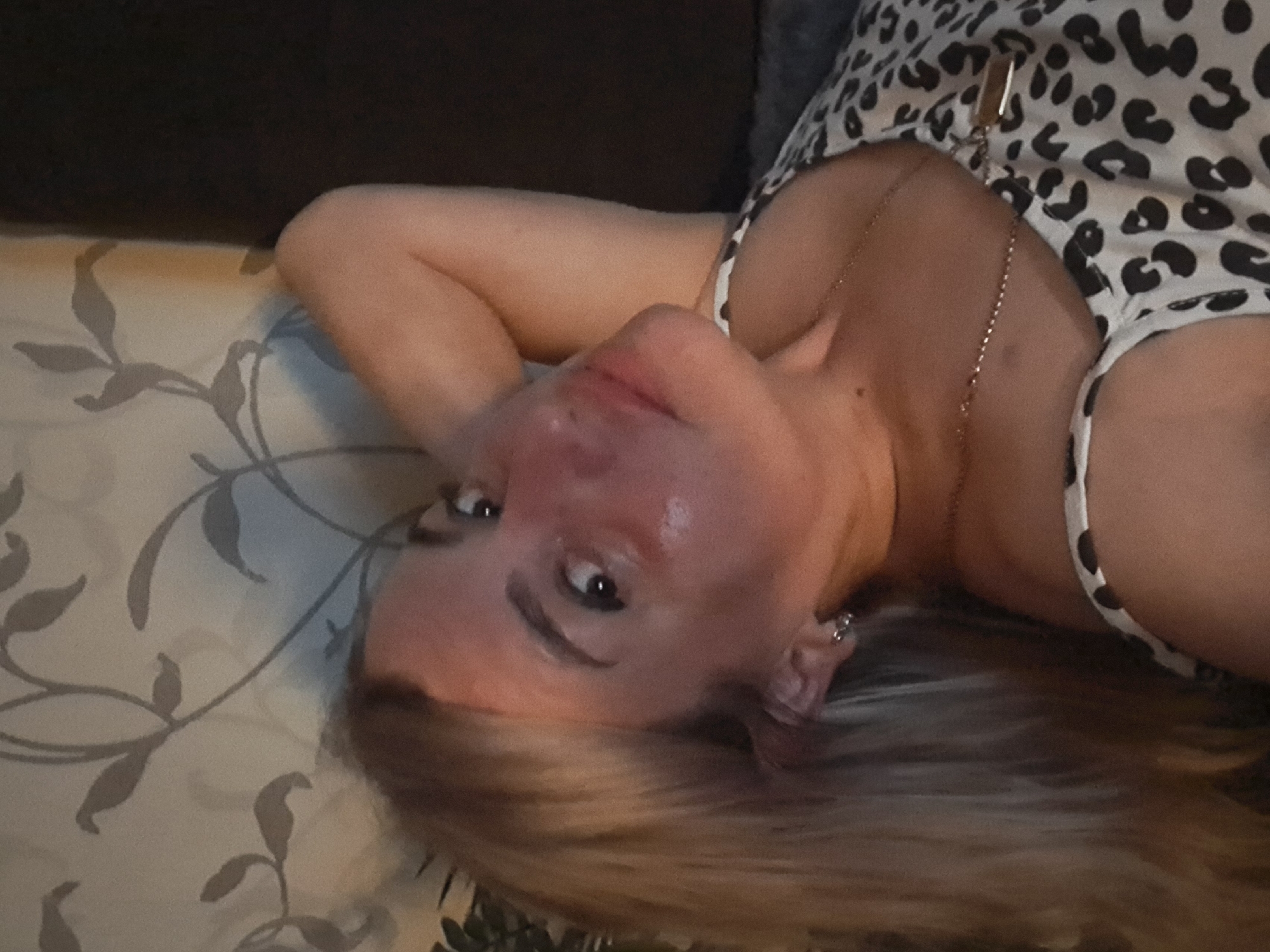 The image shows a close-up of a young Caucasian woman with blonde hair lying on her side. She is wearing a white top with a black leopard print and a thin gold necklace with a rectangular pendant. Her left arm is bent behind her head, and her right hand is resting on her cheek. Her skin appears flushed, particularly on her cheeks and nose, suggesting a possible sunburn or skin irritation. She is wearing small hoop earrings in her visible ear. The background consists of a patterned wallpaper with gray floral motifs and a dark surface, possibly a couch or bed. The scene appears to be indoors, in a domestic setting. There is no information to suggest this image is located in Elektrostal, Russia.