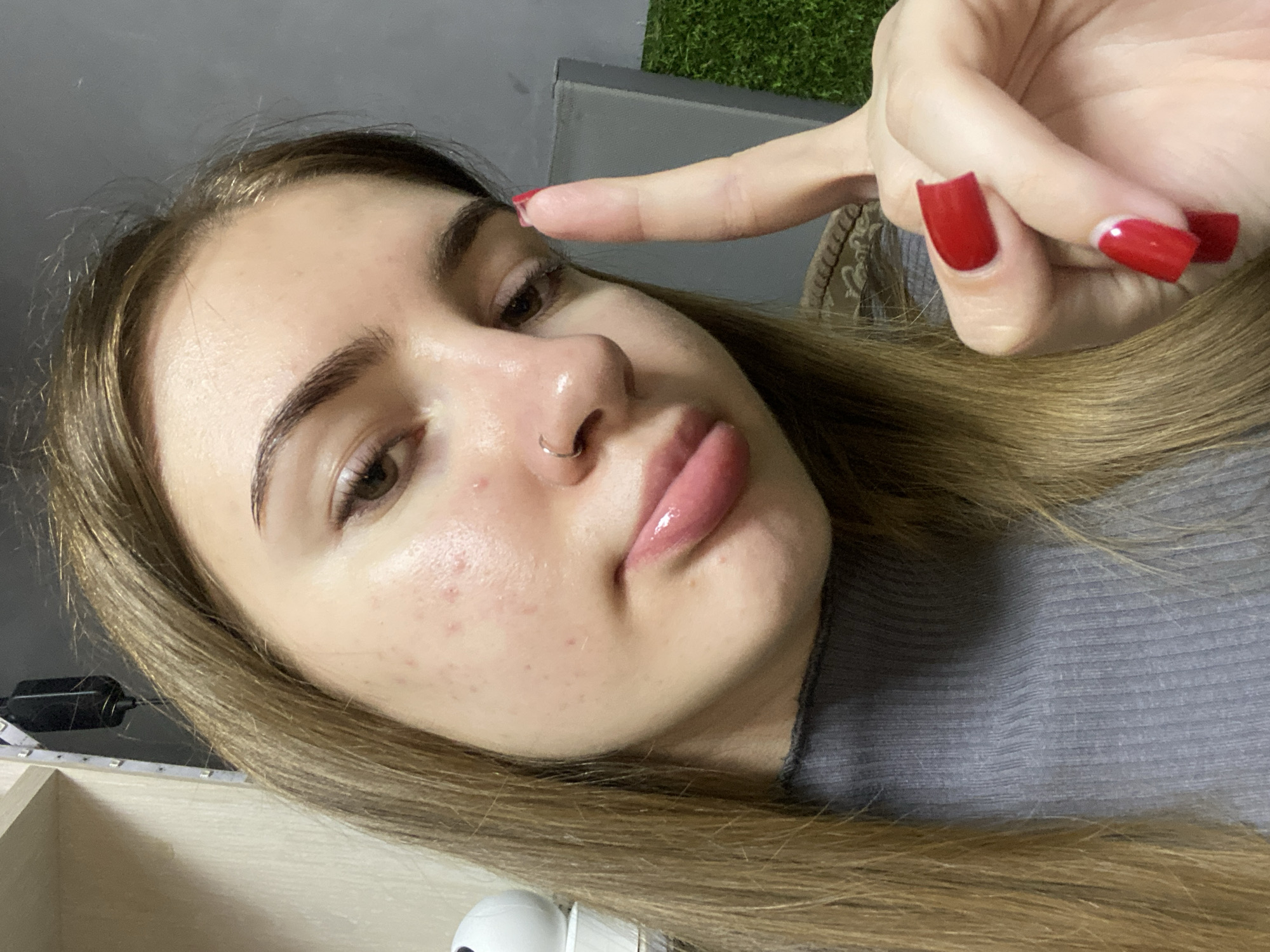 A young Caucasian woman with light brown hair is captured in a close-up, frontal shot. She is wearing a grey ribbed turtleneck sweater. Her face, particularly her cheeks and forehead, shows several red blemishes consistent with acne. She has a nose ring and her lips are glossy and plump. Her right hand is raised, with her index finger extended, and her fingernails are painted a bright red. The background is blurred, but appears to be an indoor setting with some shelving on the left and a grey wall on the right. There is also a glimpse of artificial green grass in the background. The overall lighting is soft, highlighting the texture of her skin. The image does not provide any specific information that would allow for its location to be determined within the city of Дьяково, Russia, or any other specific urban area.