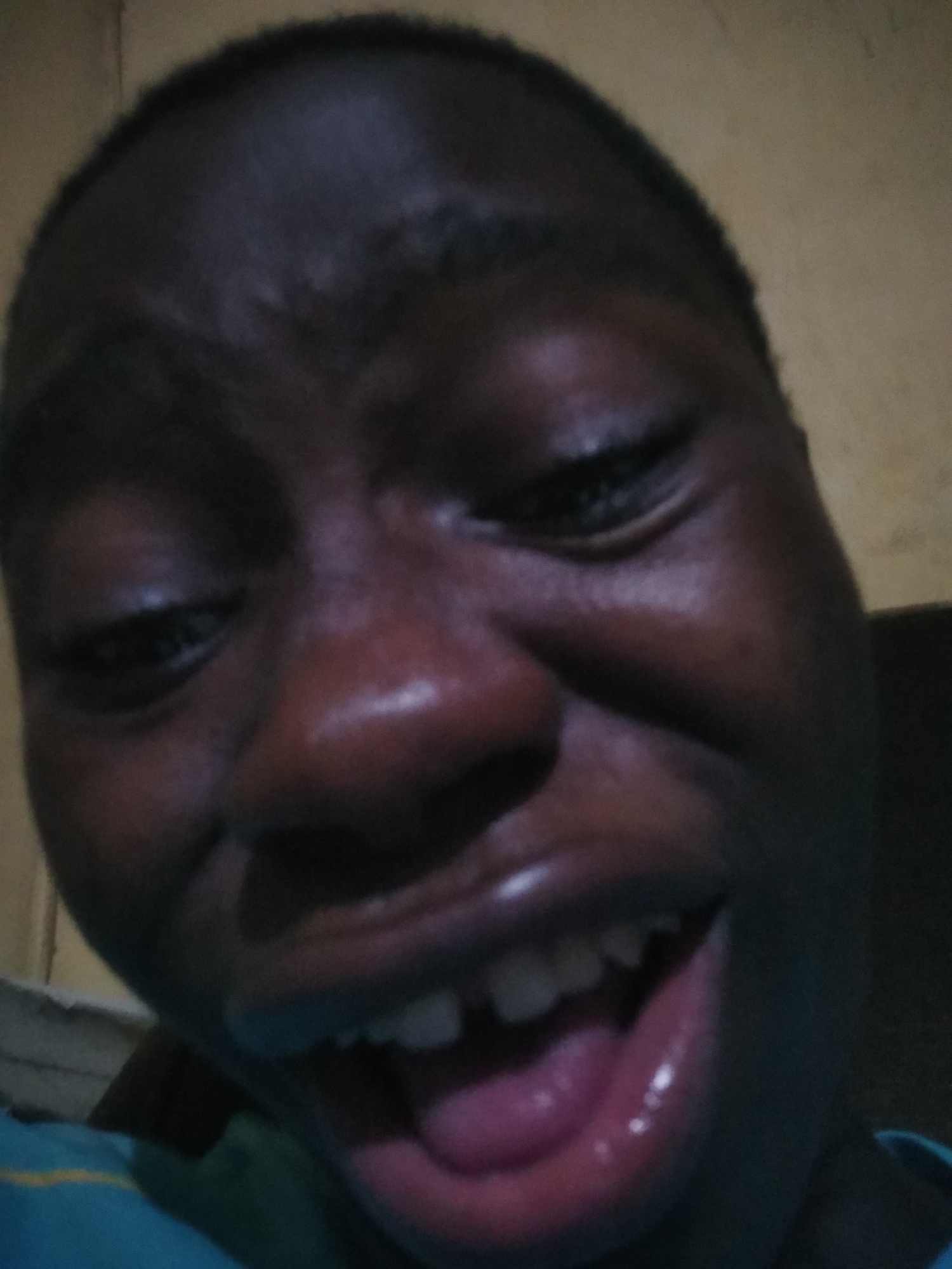 A close-up photograph depicts a dark-skinned person with a wide-open mouth, revealing teeth and tongue. The person's eyes are partially closed, and their brow is furrowed. The background appears to be an interior space with a light-colored wall. The location is not discernible from the image.