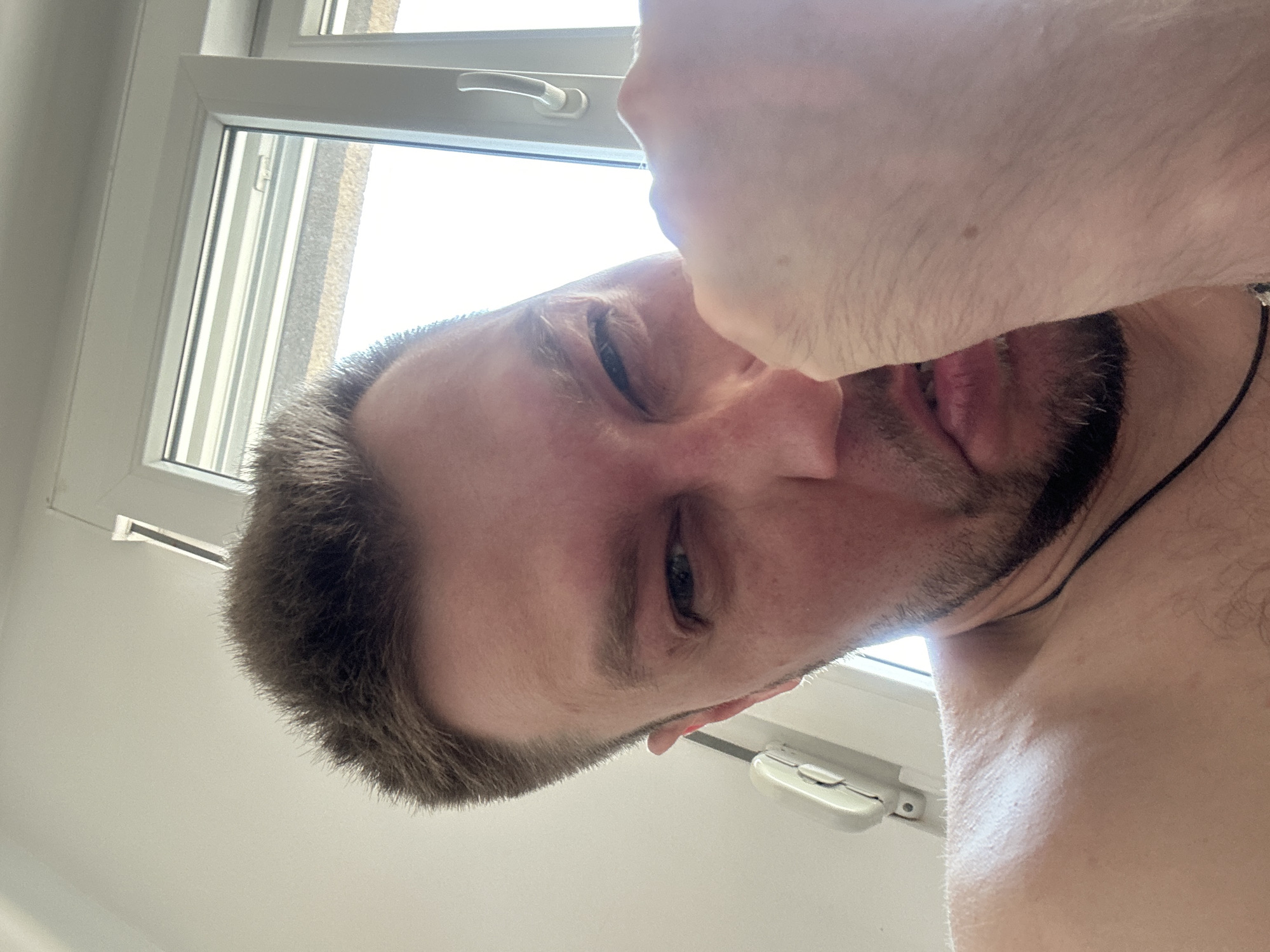 A close-up, overhead shot captures a fair-skinned man with short, brown hair and a beard. He is shirtless, revealing his bare shoulders and upper chest. A black cord necklace is visible around his neck. His right hand is raised, obscuring part of his face. His left eye is visible, and his skin appears flushed around his eyes and nose, suggesting a possible allergic reaction or irritation. The background features a white wall and a window with a white frame and a silver handle. A white object, possibly a light switch or intercom, is mounted on the wall to the left. The lighting suggests an indoor environment, likely a residential room. The presence of a window indicates it may be daytime. Based on the provided context, this scene is situated in Zvezdara Urban Municipality, Serbia.