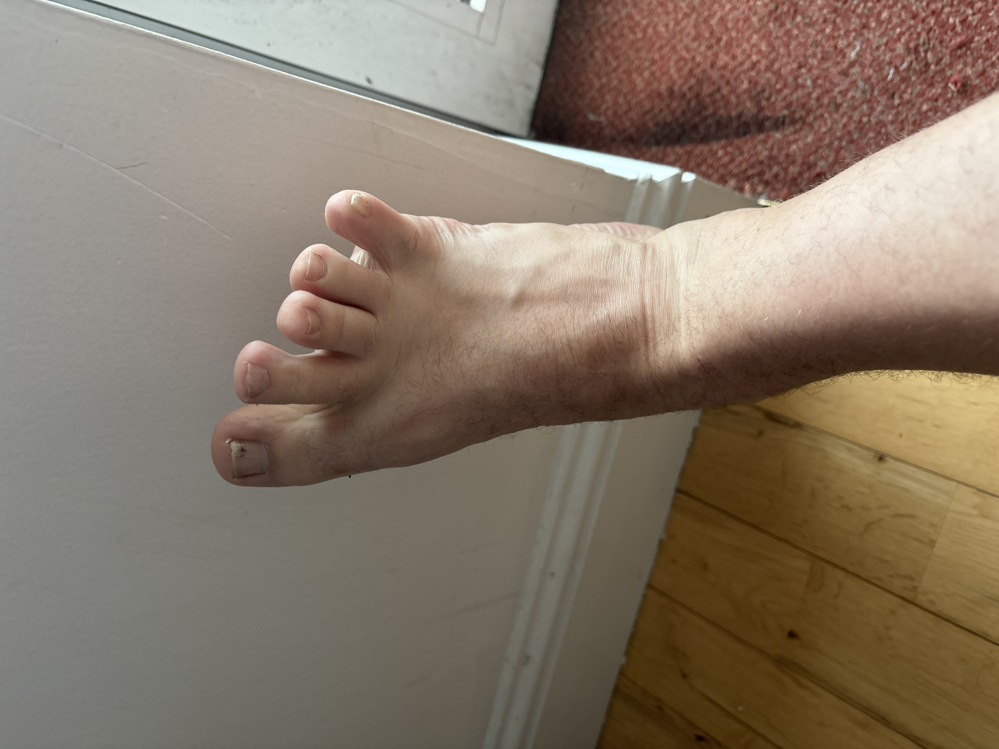 The image shows a close-up view of a person's foot, which appears to be resting on a light-colored wall with a white baseboard. The floor in the foreground is made of light-colored wooden planks, while to the right, a textured, reddish carpet is visible. The lighting suggests an indoor environment. The foot has visible toenails, some of which appear slightly damaged or discolored. The skin of the foot and lower leg is fair and shows fine hairs. The image does not provide any information about the city of Cork, Ireland, or any other specific location.