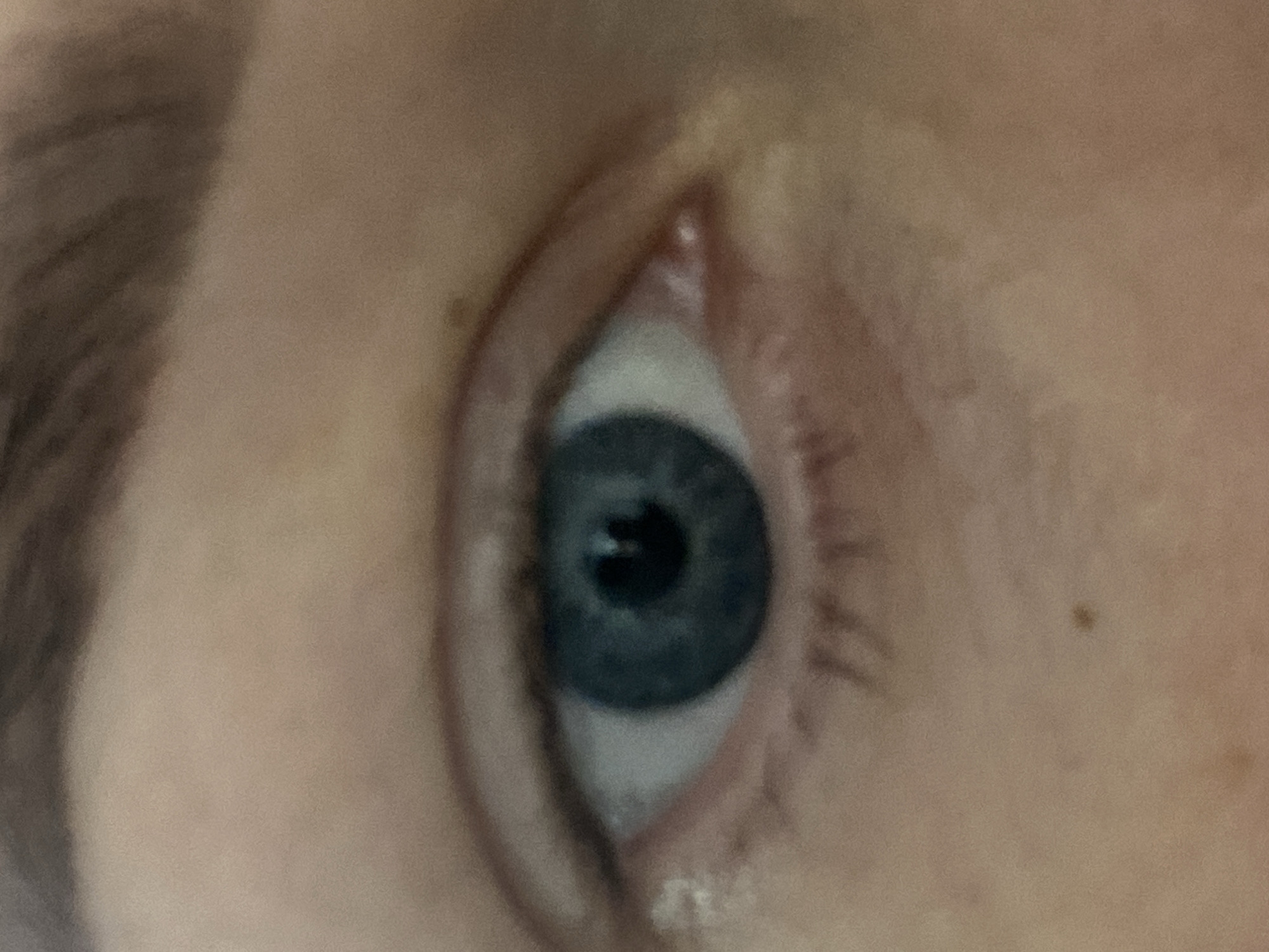 A close-up image depicts a human eye, seemingly blue in color, with the eyebrow visible in the upper left corner. Skin details, including eyelashes and minor imperfections, are noticeable. The scene provides no information about a location, including Sochi, Russia.
