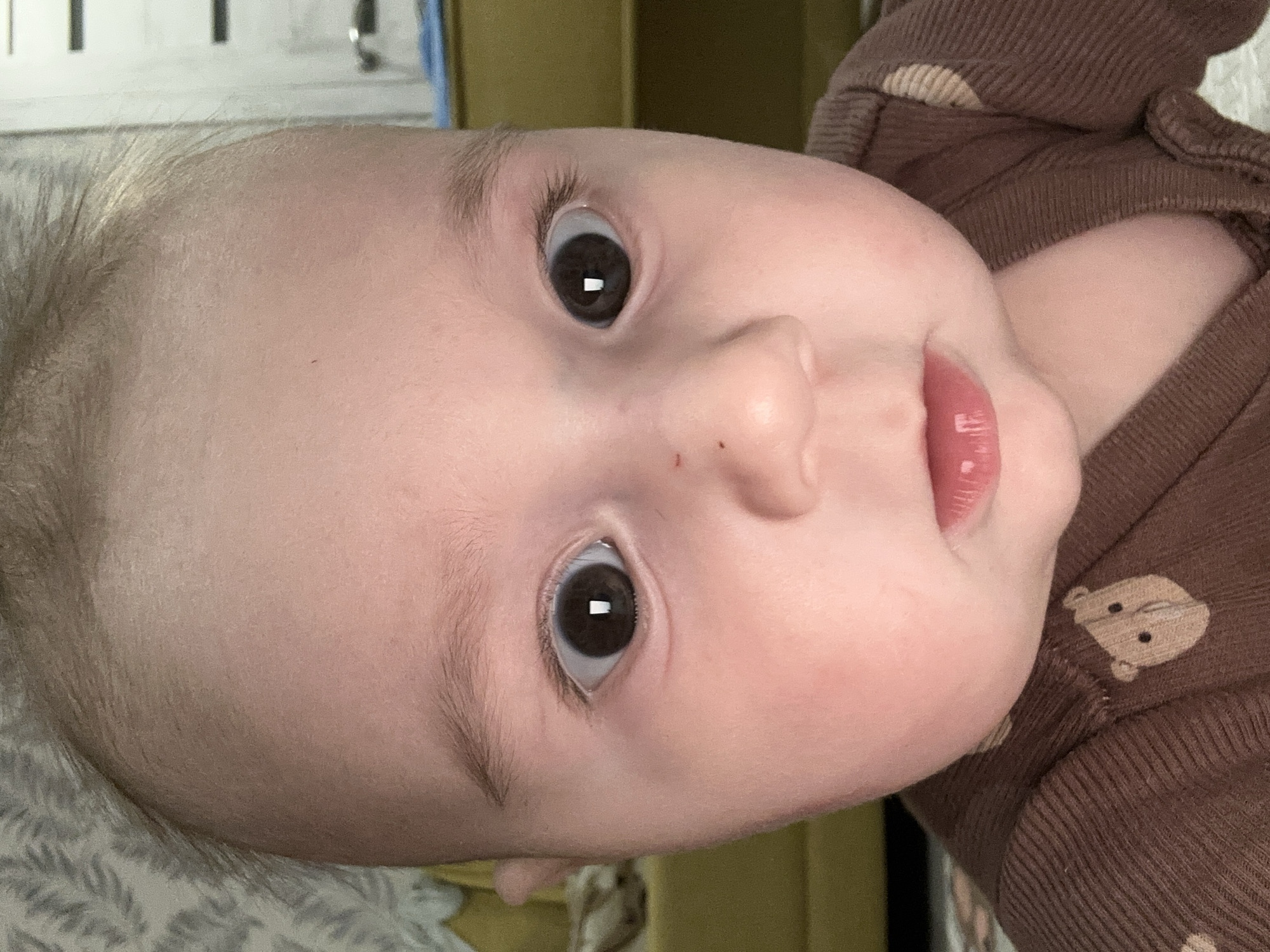 A close-up shot of a baby's face. The baby has fair skin, dark eyes, and thin eyebrows. There's a small mole on the baby's nose. The baby is wearing a brown shirt with a light-colored animal print. The background is blurred. The location is not identifiable.