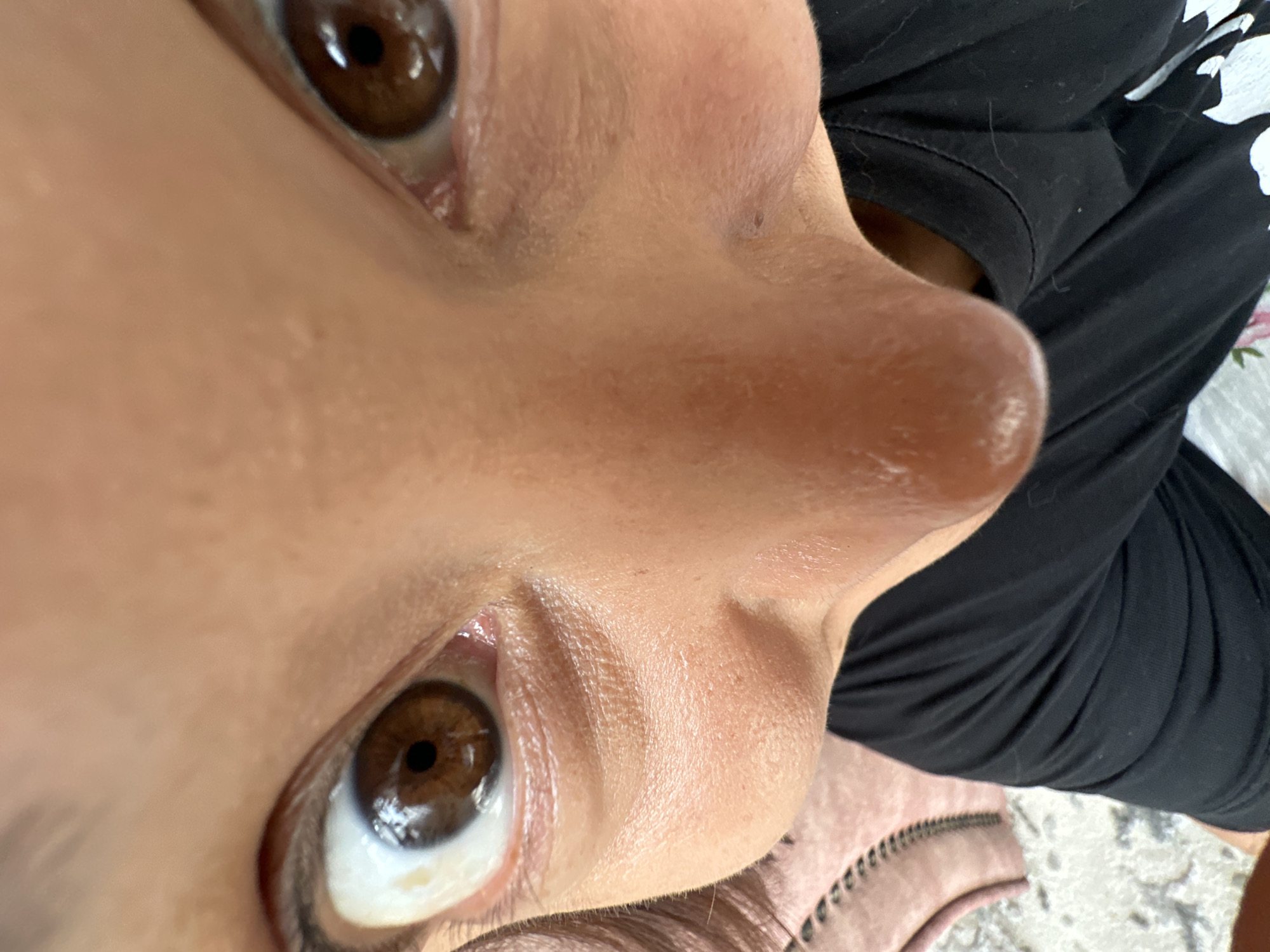 A close-up, fisheye perspective shot shows a person's face, focused on their eyes and nose. The subject has brown eyes and fair skin, with a few small blemishes visible on their nose and cheek. They are wearing a black t-shirt, and part of a pink and white patterned item of clothing is visible on the left side of the frame. The background appears to be a carpeted or tiled surface.