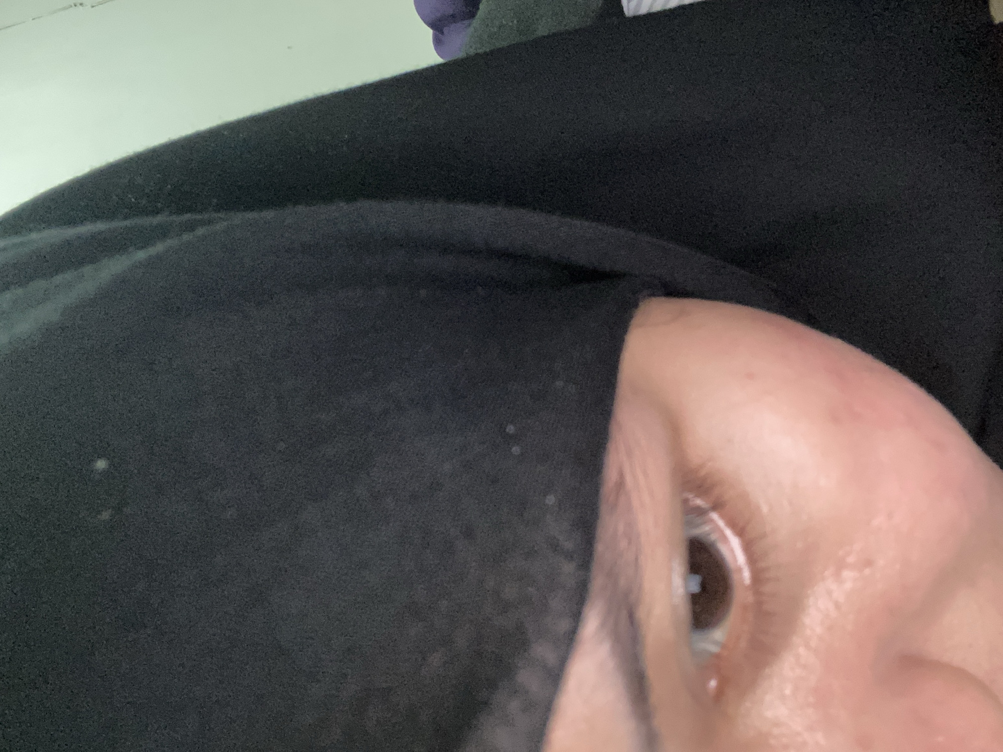 The image shows a close-up of a person's eye and part of their face, wearing a black hijab. The background is a pale green wall, with hints of purple and green fabric visible to the right, suggesting clothing or bedding. The lighting is soft, with some speckles of dust visible in the air or on the hijab. The person's skin appears to be light-toned, with visible pores and some redness. The eye is dark brown, and the iris is clearly visible. The image quality is grainy, and there are some out-of-focus areas. The provided context indicates the location is Banjarbaru, Indonesia, but this information cannot be visually verified from the image itself.
