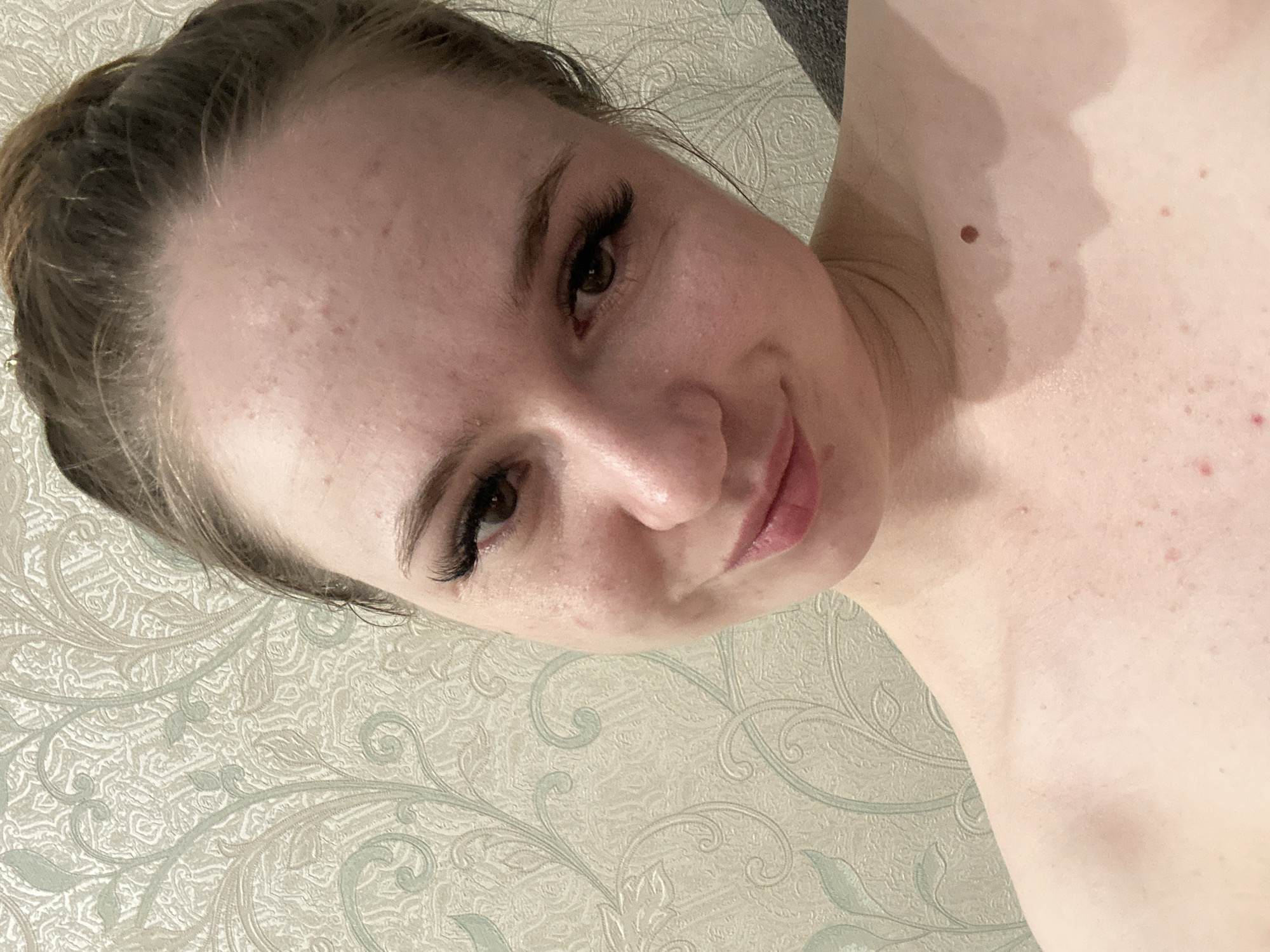A woman is looking at the camera, her face and shoulders are visible against a patterned wallpaper. She has her hair pulled up in a bun. She is wearing false eyelashes and appears to have some blemishes on her face and chest.
