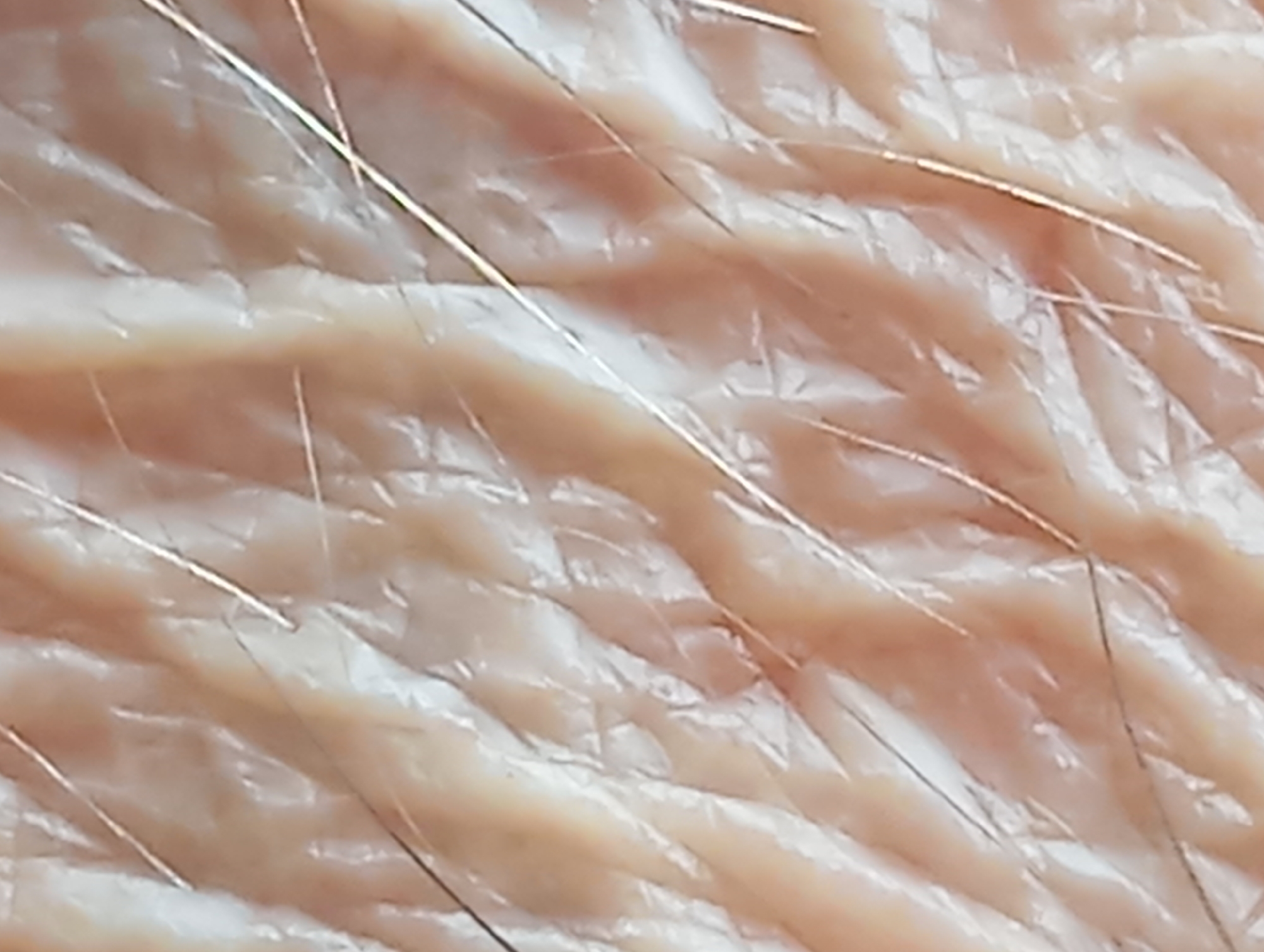 The image is a close-up, macro shot of human skin, showing the texture of wrinkles and fine hairs. The skin appears to be light-toned with a slightly pinkish hue. The lighting creates highlights and shadows, emphasizing the contours of the skin's surface. There are no identifiable objects or people in the frame, and the context of the image within the city of Nitra, Slovakia, is not discernible from the visual information provided. The image focuses solely on the intricate details of the skin's surface.