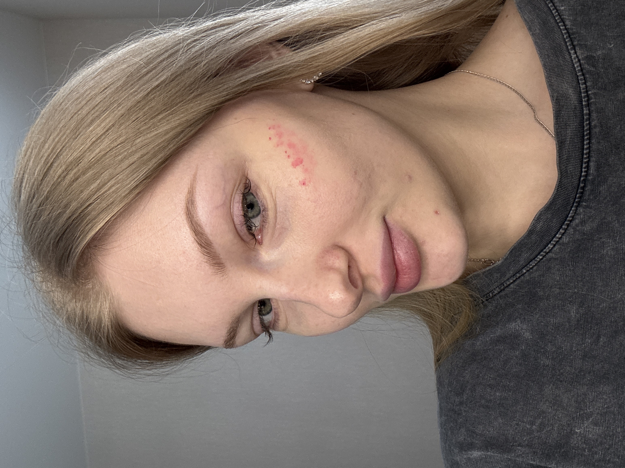 A close-up, tilted headshot shows a light-skinned woman with blonde hair. Her eyes are open and appear to be a light color. Red marks are visible on her right cheek. She is wearing a gray shirt and a thin necklace. The background appears to be a plain wall. The location is not identifiable from the image.