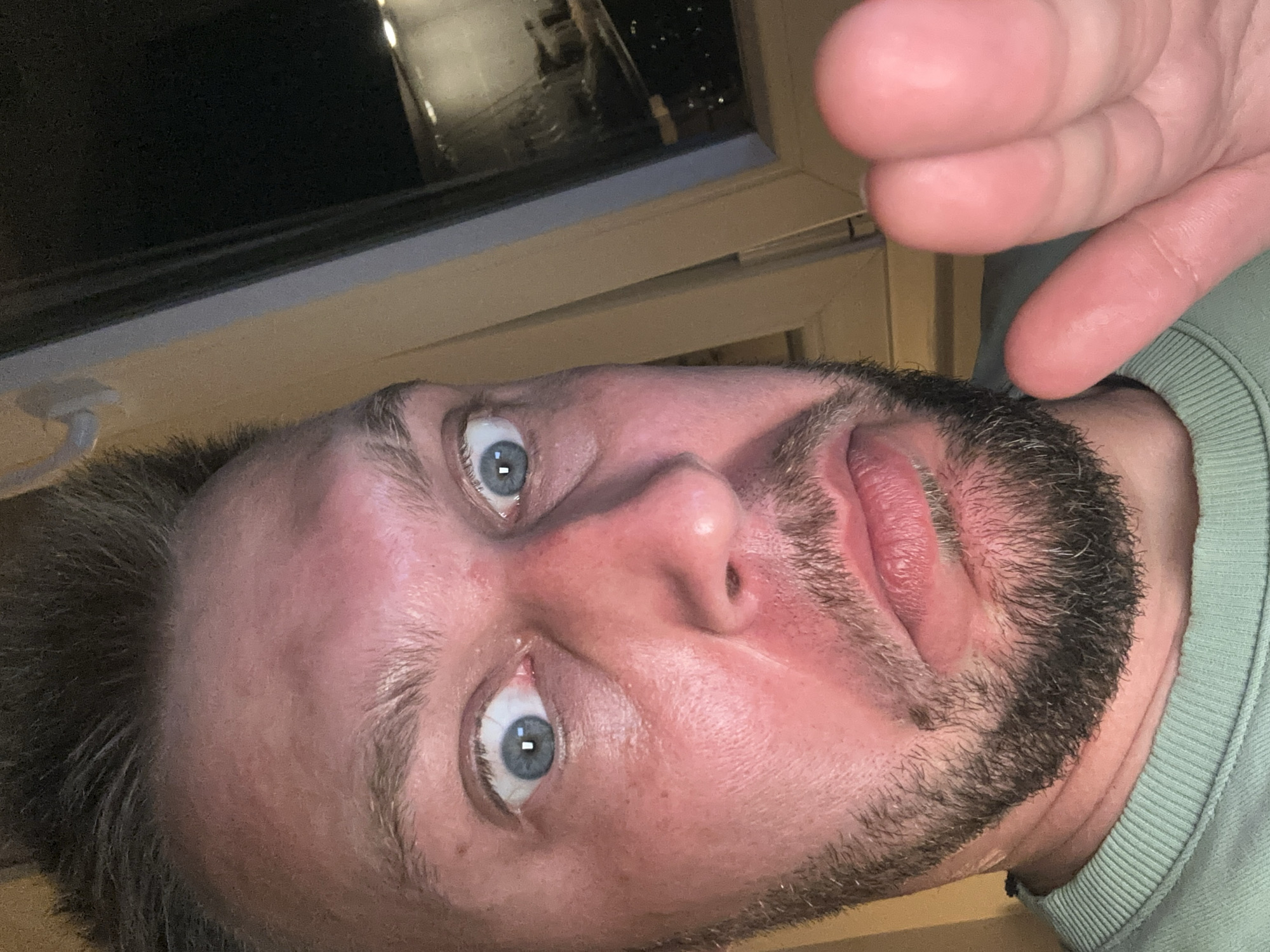 A close-up, over-the-shoulder selfie shows a man with blue eyes, light brown hair, and a beard. He is wearing a light green crew neck sweatshirt. His skin appears flushed, with some redness on his cheeks and forehead. His expression is one of surprise or concern, with wide eyes and a slightly pursed mouth. His right hand is in the foreground, obscuring part of his face. In the background, a window shows a dark, blurry scene of city lights, suggesting an urban nighttime setting. The location is not identifiable from the image.