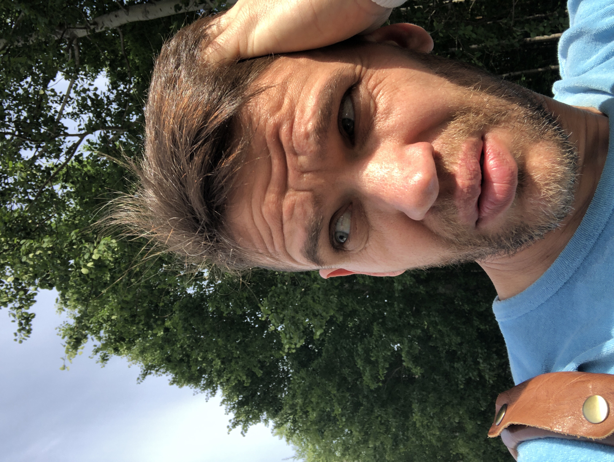 An outdoor image captures an adult male from the chest up, under bright daylight, against a natural backdrop. The subject has light brown, unstyled hair, and a light-colored beard and mustache. His skin is tanned, with prominent horizontal wrinkles on his forehead and fine lines around his light blue eyes. His eyes are directed towards the viewer's right side of the frame. His mouth is slightly open. The subject's right hand is positioned on the top of his head. He is wearing a light blue, textured garment, possibly a t-shirt. A brown leather strap featuring a brass-colored snap button is visible over his left shoulder. The background consists of dense green foliage from deciduous trees and a light blue sky, indicating an open, natural environment. This scene is depicted in an outdoor area within the city of Saint Petersburg, Russia.