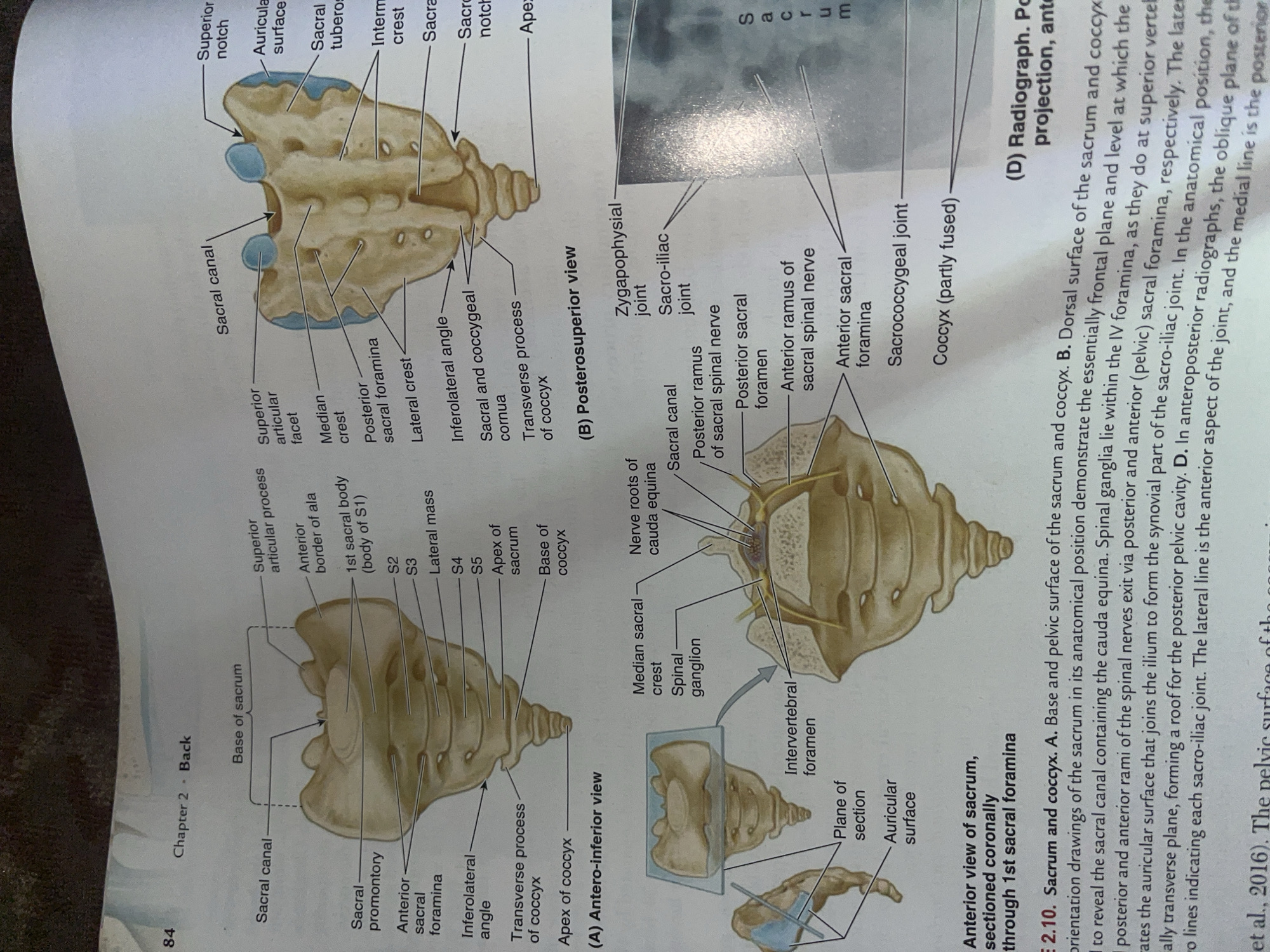 The image is a diagram of the human sacrum and coccyx, illustrating anatomical features from different views. There is no information about Jalingo, Nigeria, or any forensic scene in this image. The image is purely anatomical.