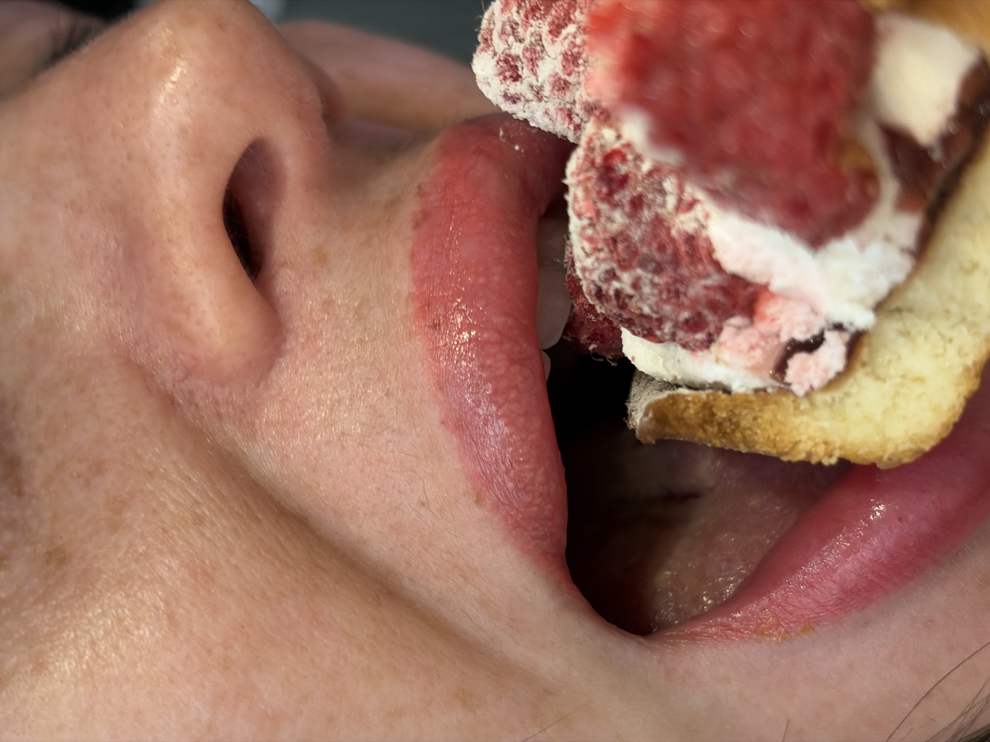 The image provides a close-up, eye-level perspective of an individual's lower face. No visual indicators within the image define its specific geographical location, including Saint Petersburg, Russia. A light-skinned person is shown in the act of eating, with their mouth wide open. The lips are a reddish-pink, appearing moist, with a discernible reddish mark or irritation on the upper lip towards the left. The tongue is visible inside the oral cavity, along with the lower teeth. The nose is prominent in the upper center of the frame, showing nostril detail. A dessert item is positioned to enter the open mouth. The dessert consists of a light-colored cake or pastry base topped with white cream or frosting and several red berries, primarily identifiable as raspberries. Many of the berries are partially covered with white powdered sugar, giving them a frosted appearance. The background is uniformly dark and out-of-focus, providing no specific environmental details. The scene is illuminated by direct, bright lighting.