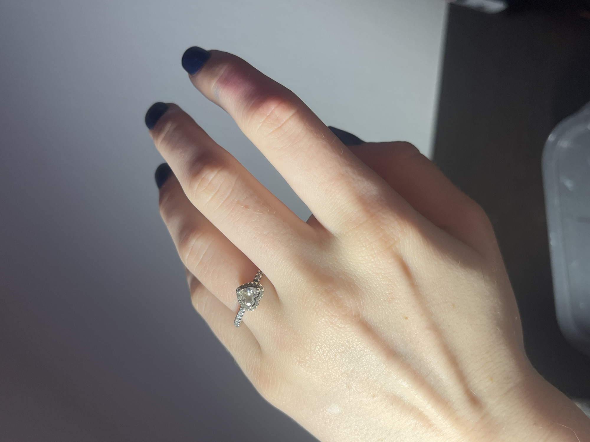 A Caucasian woman's hand, adorned with a silver engagement ring with a heart-shaped central stone and smaller stones along the band, is prominently displayed. The fingernails are painted in a dark navy or black color. There is a visible bruise or discoloration on the middle finger, near the tip and extending towards the first knuckle. The background is a dimly lit, neutral tone, with a glimpse of a table and what seems like a clear plastic container. No identifiable location in Saint Petersburg, Russia, is discernible from the image.