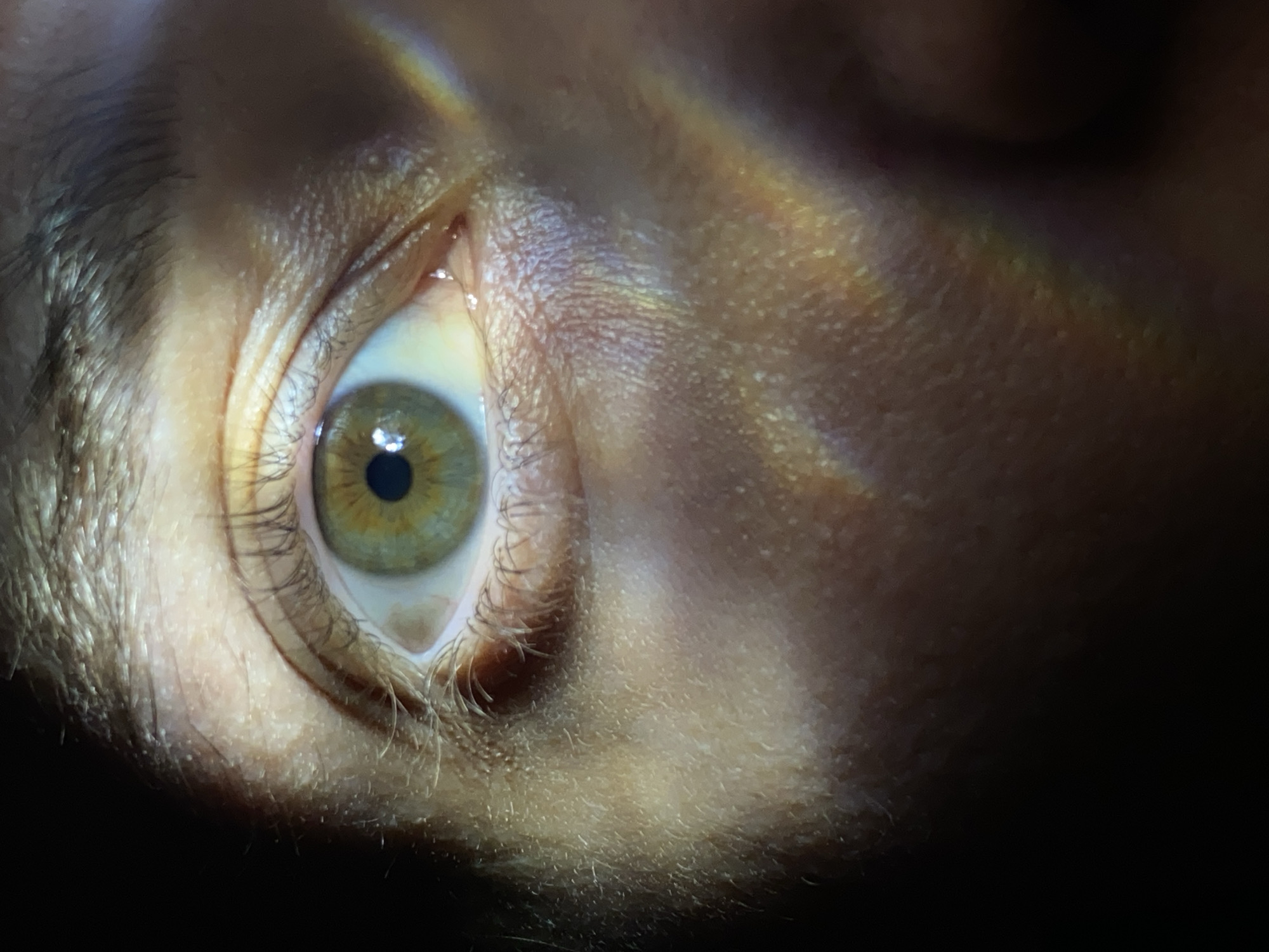A close-up image of a human eye dominates the frame. The iris is multi-toned, showing a range of olive-green and brown colors around the pupil. The sclera appears slightly yellowed. The surrounding skin is fair-skinned, with visible texture and hair follicles. Lighting is dramatic, with a bright highlight creating a rainbow-like effect across the upper eyelid and cheekbone, contrasting with the dark, shadowy lower portion of the frame. No specific indicators of the location, Chaikovsky, Russia, can be identified based solely on the image. No additional people, objects, actions, or interactions are depicted.