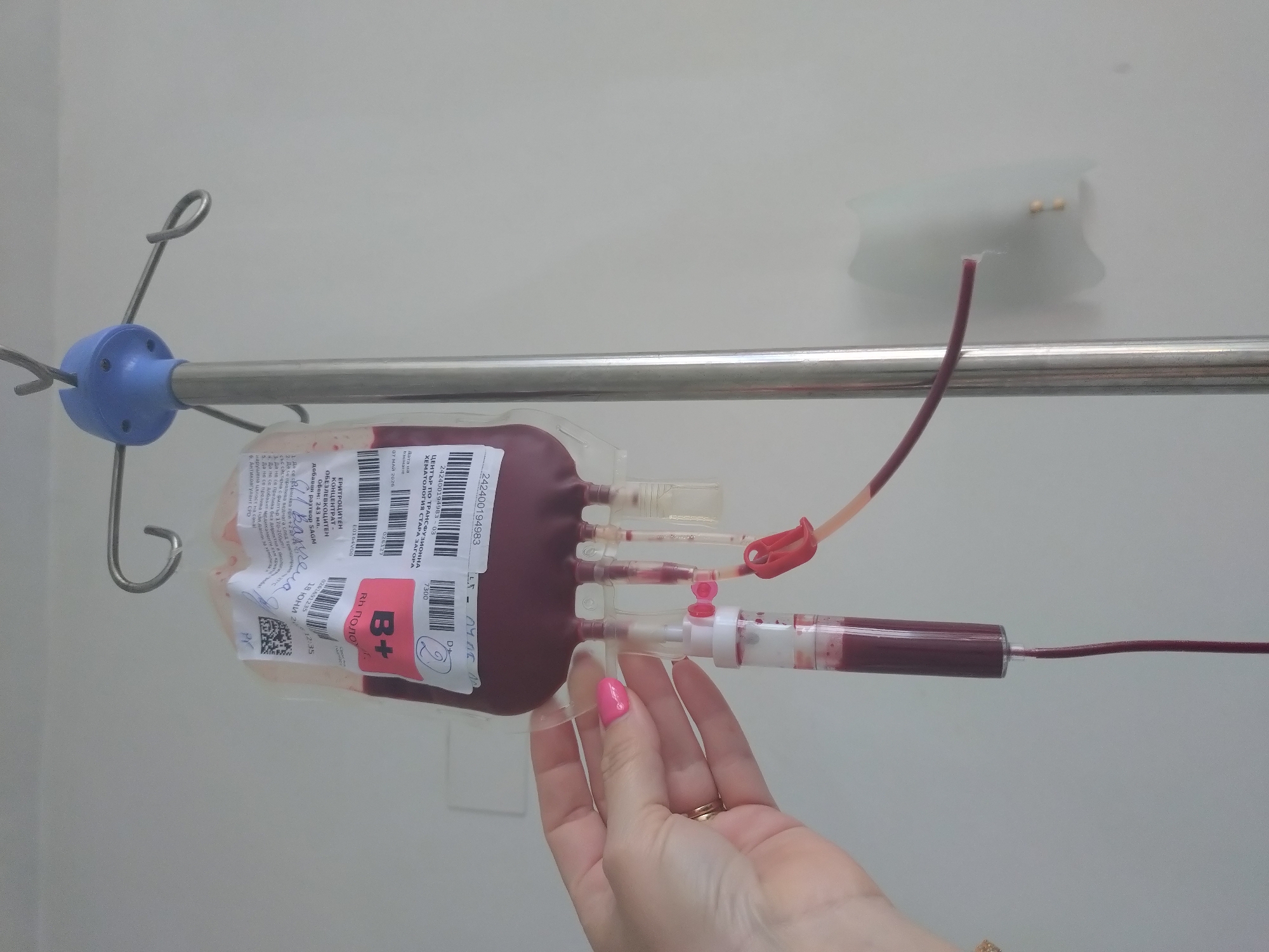 A close-up, horizontal shot shows a blood bag filled with dark red erythrocyte concentrate, hanging from a metal IV pole with a blue plastic holder against a light-colored wall. A person's hand, with pink nail polish and wearing a ring, is seen holding the tubing connected to the bottom of the blood bag. Several clear plastic tubes, some containing blood, extend from the bag. One tube, further to the right, also contains blood and appears to be a sample or part of the administration set. Another red tube with a clamp is visible near the top right of the bag.
The labels on the blood bag are largely visible and provide key information:
* It's an "ЕРИТРОЦИТЕН КОНЦЕНТРАТ - ОБЕЗЛЕВКОЦИТЕН" (Erythrocyte Concentrate - Leukocyte-depleted).
* The blood type is "B+" (B positive) and "Rh поло" (Rh positive).
* The volume is "243 мл." (243 ml).
* It contains "добавен разтвор SAGM" (added SAGM solution).
* The source is "ЦЕНТЪР ПО ТРАНСФУЗИОННА ХЕМАТОЛОГИЯ СТАРА ЗАГОРА" (Center for Transfusion Hematology Stara Zagora), indicating the location context is Stara Zagora, Bulgaria.
* An expiry or testing date is "07 МАЙ 2026" (07 May 2026).
* Other identifiable text includes "242400194983" (likely a unit ID), "18 ЮНИ 2" (18 June 2, possibly part of a collection date), and "12:35".
* Partial instructions/warnings are visible in Bulgarian, relating to storage and transfusion procedures.
The scene depicts the preparation or ongoing process of administering blood in a medical setting, likely a hospital or clinic, as indicated by the IV pole and blood product.