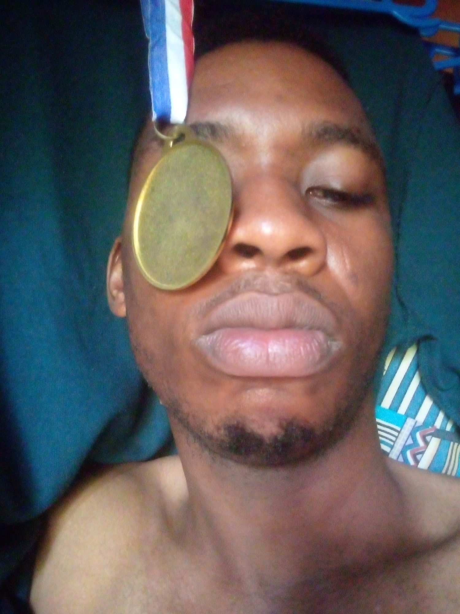 A close-up, indoor shot shows a Black man lying down, with a gold medal on a red, white, and blue ribbon covering his left eye. He is shirtless, with a dark green blanket behind his head and shoulders. The background includes a blue and white striped pillow. The city and precise location are Unknown, Unknown.