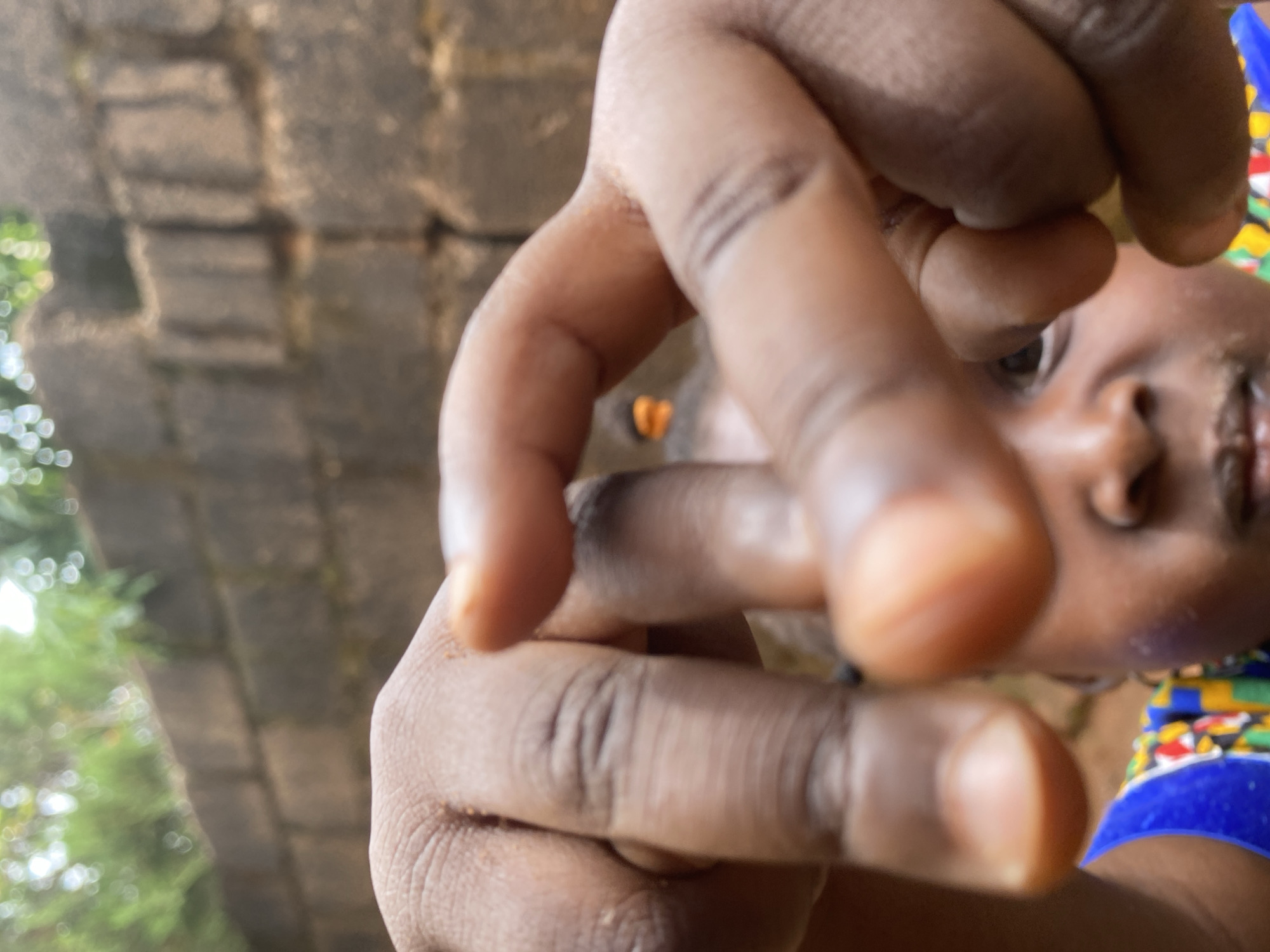 This close-up image, taken in Kuru Dungus, Nigeria, features a person partially obscured by outstretched hands, seen from a low-angle perspective. The photo appears to be rotated, with the subject's face positioned on the right.
In the foreground, prominent dark-skinned fingers are splayed and partially curled, creating a blurred, abstract shape that dominates the left and central parts of the frame. Their extreme proximity to the camera lens renders them out of focus, highlighting the skin's texture.
Behind these fingers, on the right side, the lower half of a face is partially visible, from the nose down to the chin, along with a portion of the cheek and ear. The skin tone is dark, consistent with the hands. The face is also blurred but suggests a young individual, possibly a child, with an eye looking towards the camera. Below the face, on the far right, a vibrant piece of clothing or fabric is visible, adorned with colorful patterns in blue, yellow, red, and green, indicative of traditional or lively attire.
The background is significantly out of focus. On the left, lush green foliage, likely trees or bushes, is visible with pronounced bokeh effects, confirming an outdoor setting. Towards the upper left and middle, a grey, textured structure, possibly a wall or building made of stone or concrete blocks, adds to the backdrop. A small, indistinct orange shape is faintly visible further back, behind the foreground fingers.
The activity suggests an interactive and possibly playful moment, with the individual reaching towards or engaging with the camera. The lighting indicates it is daytime. No text is visible. The scene conveys a sense of spontaneity and closeness.