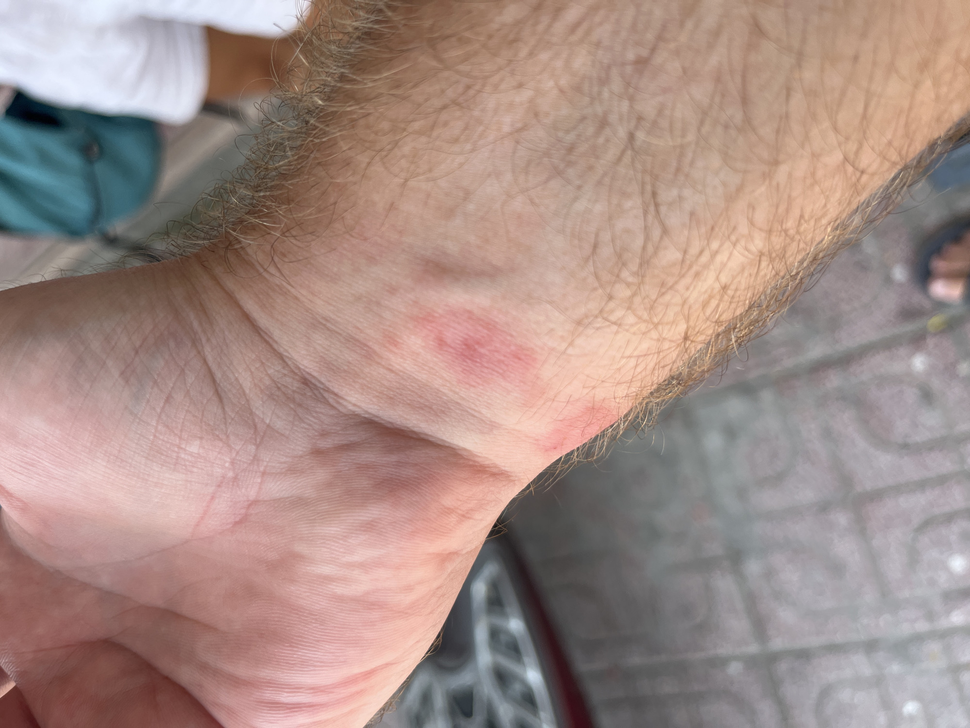 A close-up photograph shows the inner wrist and forearm of a light-skinned person. Two small red marks are visible on the wrist, possibly indicating irritation or insect bites. The person has light brown hair on their arm. The background is blurry, but elements of a tiled walkway and a vehicle wheel are visible. Based on the metadata, the image was likely taken in or near Bac Nha Trang Ward, Vietnam, given the location tag associated with the image.