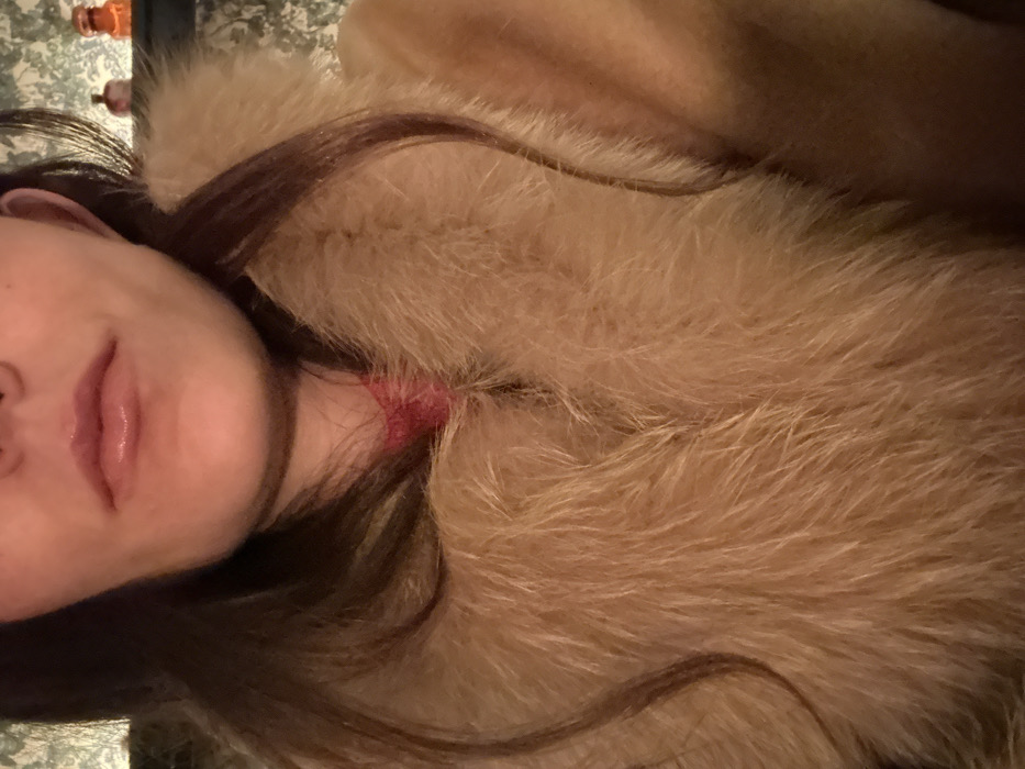 A woman's face, including part of her nose, mouth, and ear, is visible. She has dark hair. She wears a tan-colored fur garment. A red, irritated area is visible on her neck. A surface with a patterned design is in the background. The image appears to be taken at an angle.