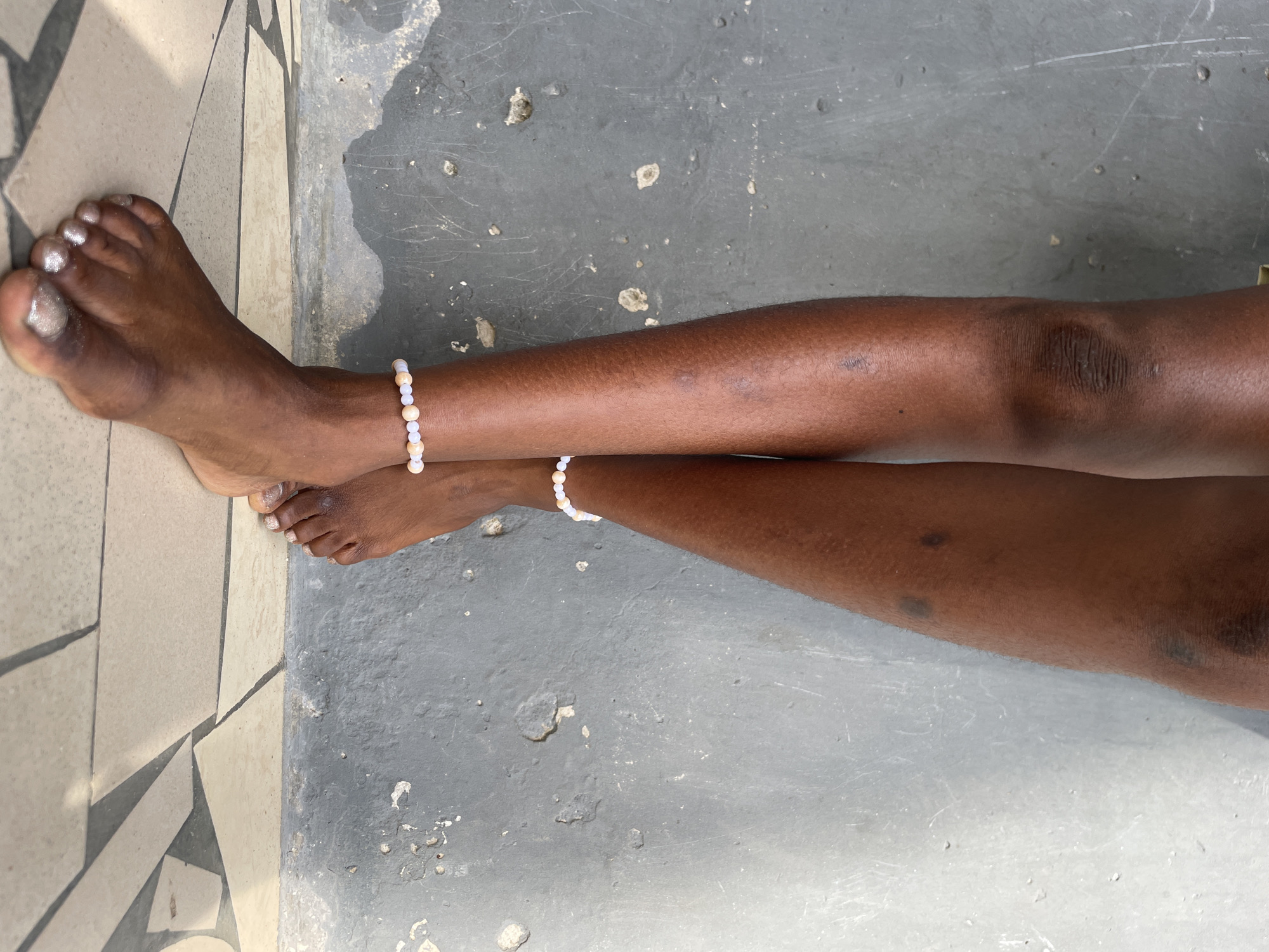 The image shows a pair of dark-skinned legs resting on a concrete floor. The legs are adorned with beaded anklets. The toenails are painted with glittery silver polish. The floor has a gray section and a tiled section with a geometric pattern. The location is Badagry, Nigeria.