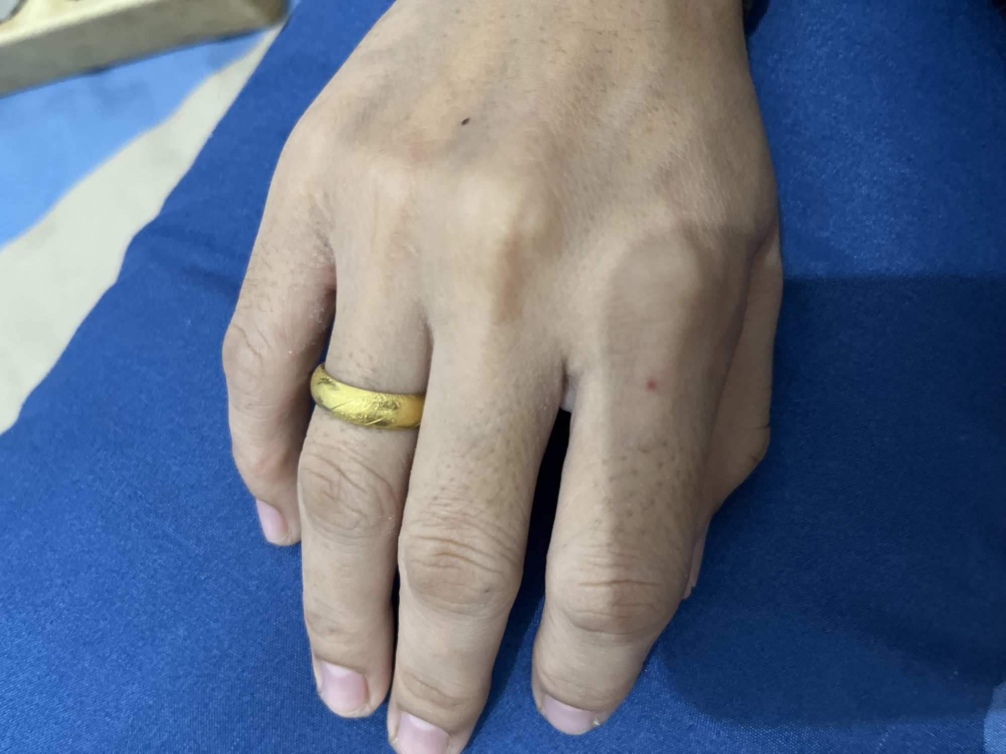 The image displays an adult human hand, likely an individual with a light to medium skin tone, resting on a surface covered by blue fabric. A textured, gold-colored ring adorns the fourth finger of the hand. The back of the hand shows some fine hair and subtle veins. A small, dark mole or freckle is visible near the center of the back of the hand, and a minor reddish mark is present near the base of the pinky finger. The fingernails are visible, appearing clean and unpolished.
The dominant background is a royal blue fabric, exhibiting a woven texture that suggests material like cotton or denim. In the upper left corner, a blurred section reveals a pattern of light blue and white stripes, possibly another piece of fabric or part of the same item. The overall lighting suggests an indoor setting. No specific activity beyond the hand resting is depicted. There is no visible text in the image. The scene is set in Lhokseumawe, Indonesia.