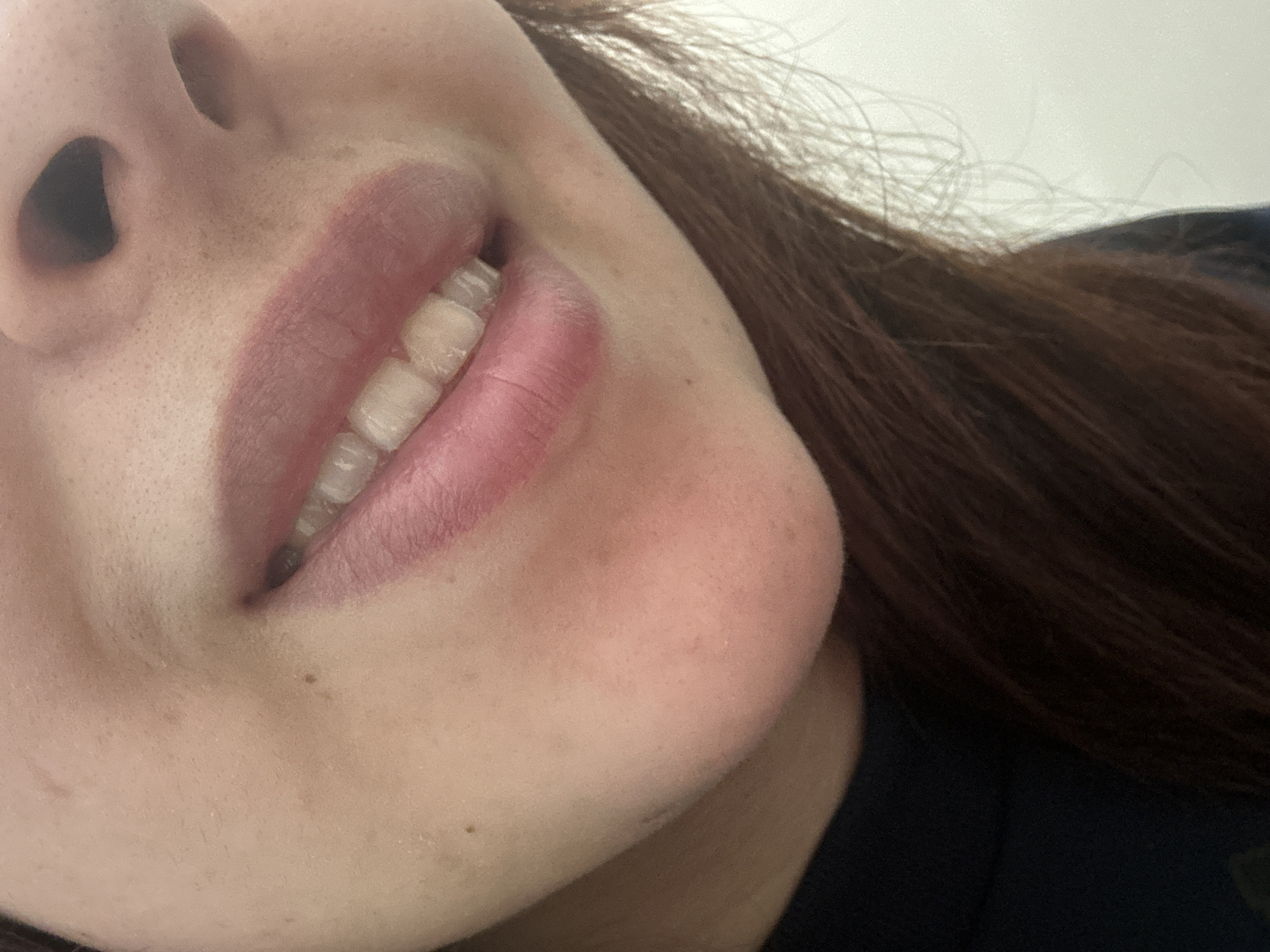 The image presents a tight, angled close-up of a person's lower face, situated in the city of Sofia, Bulgaria. The central focus is the subject's mouth, which is slightly agape, revealing the upper row of natural teeth in what appears to be a subtle smile. The lips are moisturized and display a pinkish-mauve coloration. The chin and lower right cheek are visible, exhibiting light skin texture, with a few small dark moles present on the cheek and near the chin. The lower part of the nose, including the nostrils, is visible at the top center. Dark brown hair is present along the right side and lower left periphery of the frame. A dark, non-descript garment is visible along the bottom left edge. The background is uniformly out of focus, indicating a shallow depth of field, with a lighter, featureless surface dominating the upper right and a darker area on the lower left, consistent with an indoor environment.