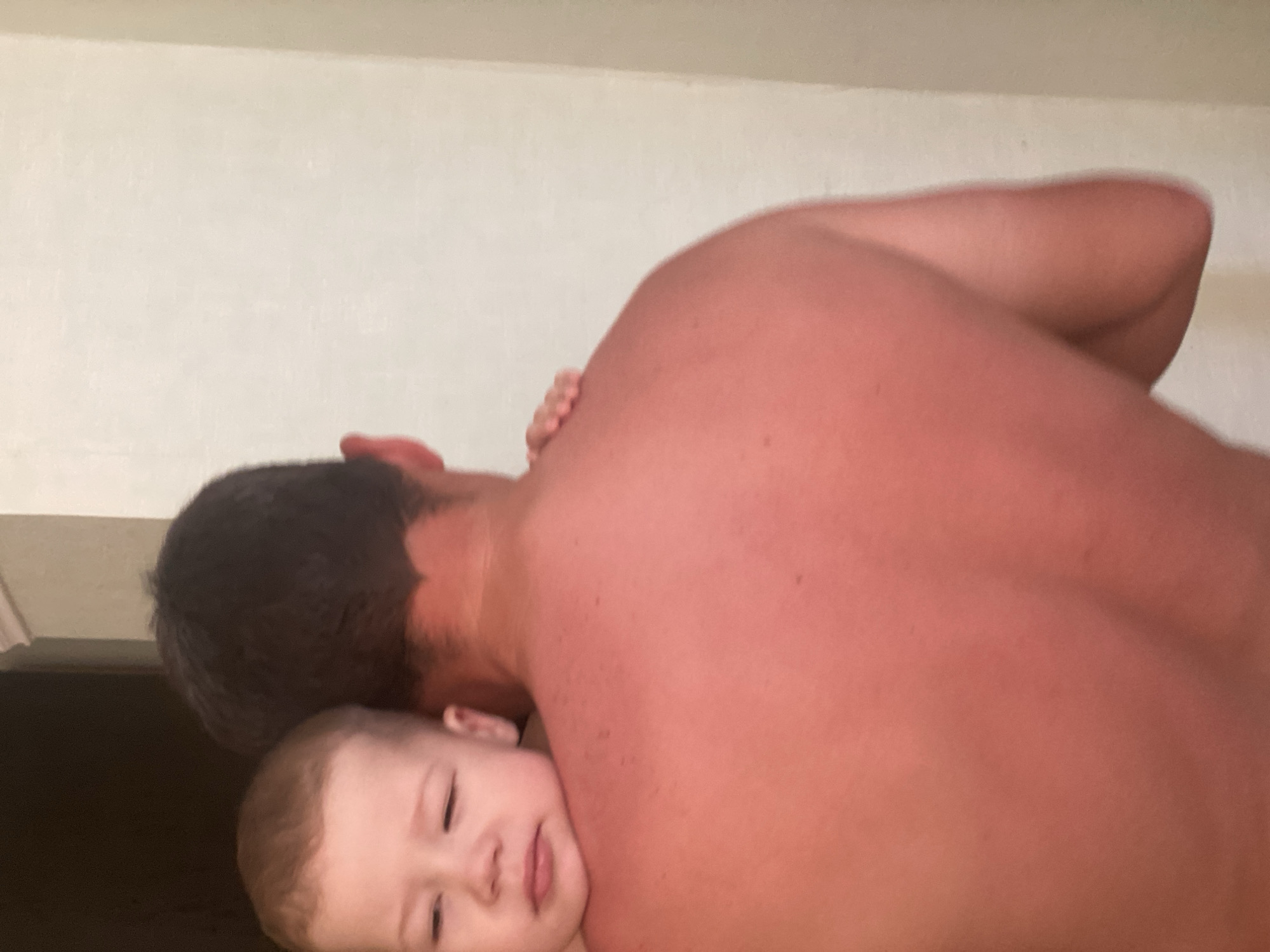 The image shows an adult, observed from behind, holding a young child on their shoulder. The adult's back, shoulders, and neck exhibit a pronounced reddish tone consistent with sunburn. Dark, short hair is visible on the adult's head. The child, with light brown hair, is seen resting their head on the adult's left shoulder. The child's face is partially visible, featuring squinted eyes and pursed lips. A small hand belonging to the child lightly grips the adult's right shoulder. The background is a plain, light-colored wall, with a darker architectural feature or doorway visible on the left side. A decorative molding runs along the top left edge of the wall. This scene is situated in the city of Sochi, Russia.