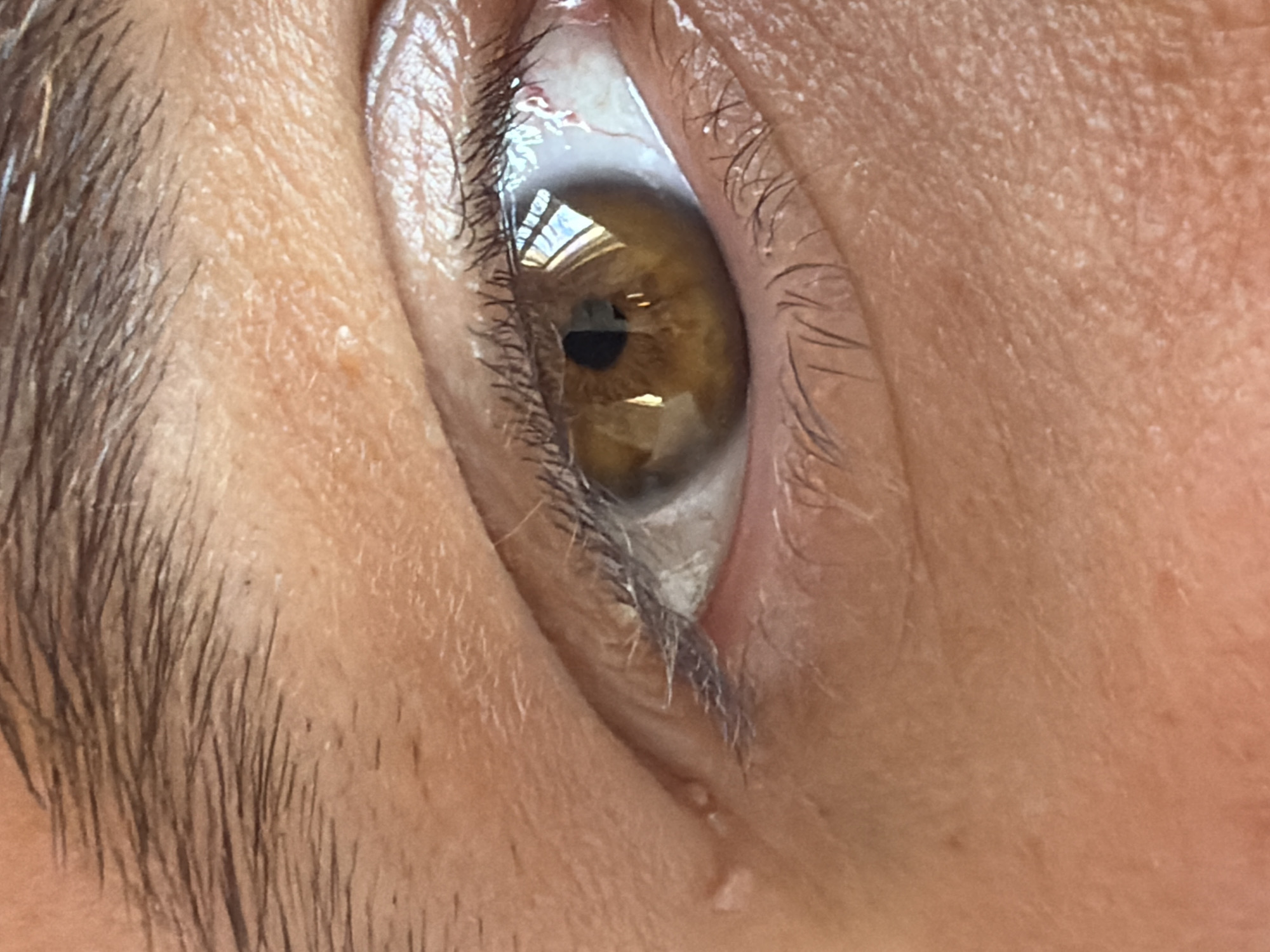 The image is a close-up, angled shot of a human eye. The iris is a warm, medium brown color with lighter flecks and darker radial lines. The pupil is a dark, circular void in the center. The sclera is visible around the iris, with some fine red blood vessels. The eyelids are lined with dark eyelashes, and the skin surrounding the eye shows subtle texture and pores. There is a slight reflection visible in the eye, suggesting an indoor or well-lit environment. The overall lighting creates a warm tone. The image does not contain any elements that would allow for location identification within Kassandra Municipal Unit, Greece.