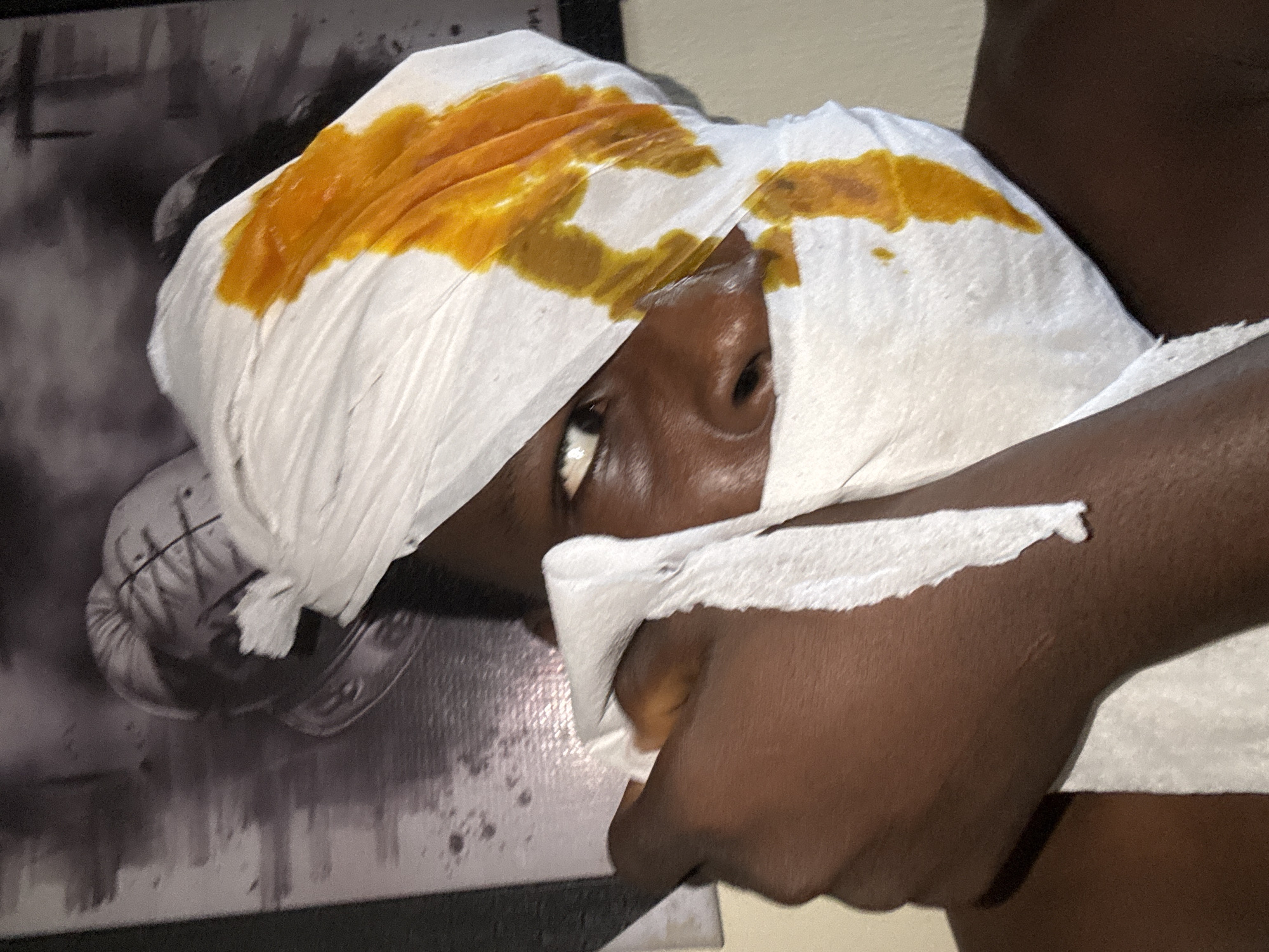 The image shows a close-up of a person's face, partially covered by a white cloth stained with a yellow-orange substance. The person appears to be holding another piece of white cloth up to their face. The background is dark and indistinct, with what appears to be a framed image or poster on the wall. The scene is likely indoors, but no specific location in Ihiagwa, Nigeria can be determined from the visual information provided.