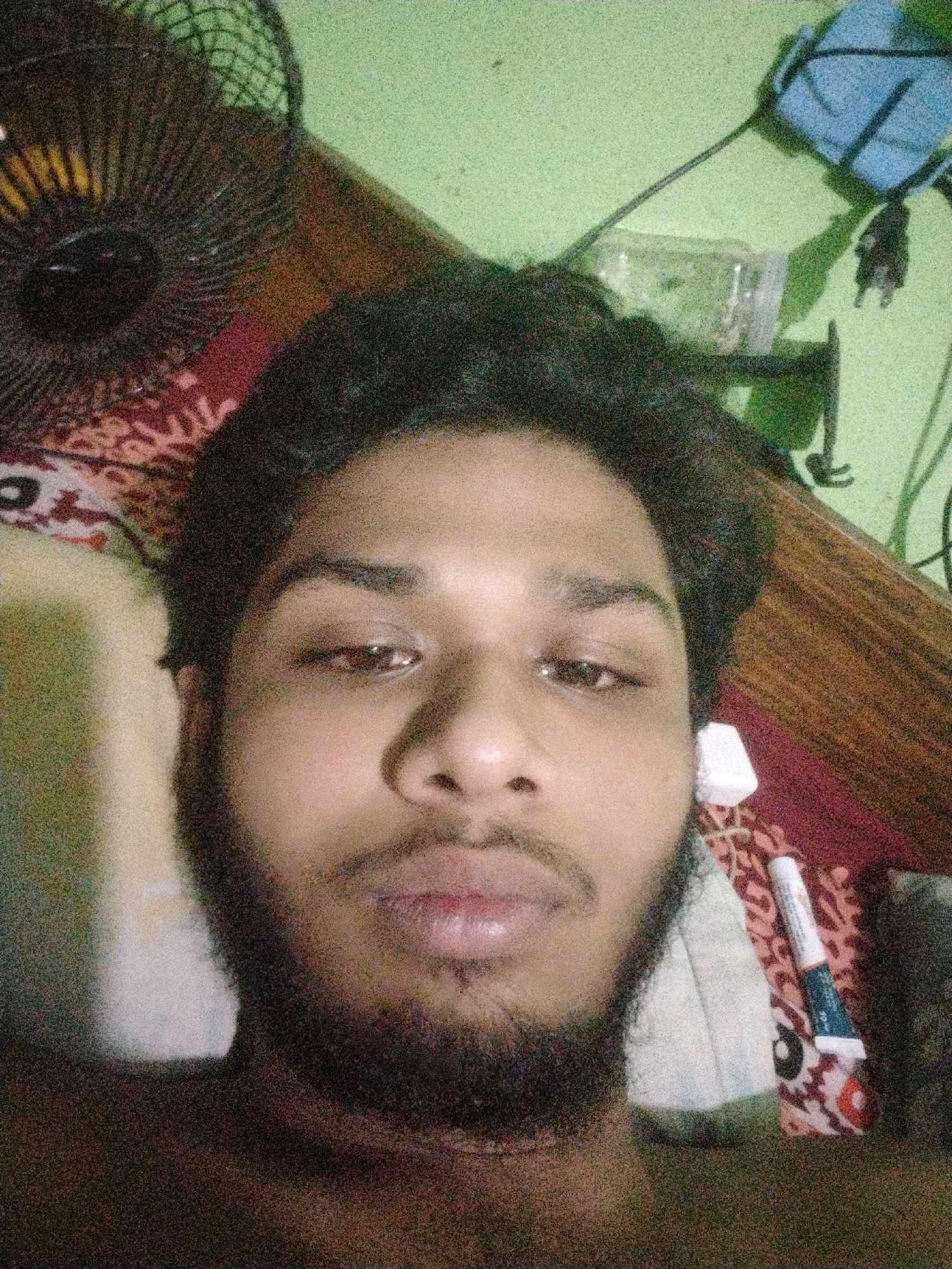 In an indoor setting, possibly a bedroom in Dhaka, Bangladesh, a young man is seen in a close-up selfie. The background reveals a light green wall with some electrical wiring and a blue object that might be a fan or a lamp. A wooden surface is also visible, suggesting furniture. The man has dark, curly hair and a beard. His right eye appears slightly red. He is lying down, as indicated by the angle and the presence of a pillow or mattress beneath him, which is covered with a patterned fabric. A tube of what appears to be ointment or medication is placed on the fabric near his face. The lighting is dim, and the image quality is poor due to noise.