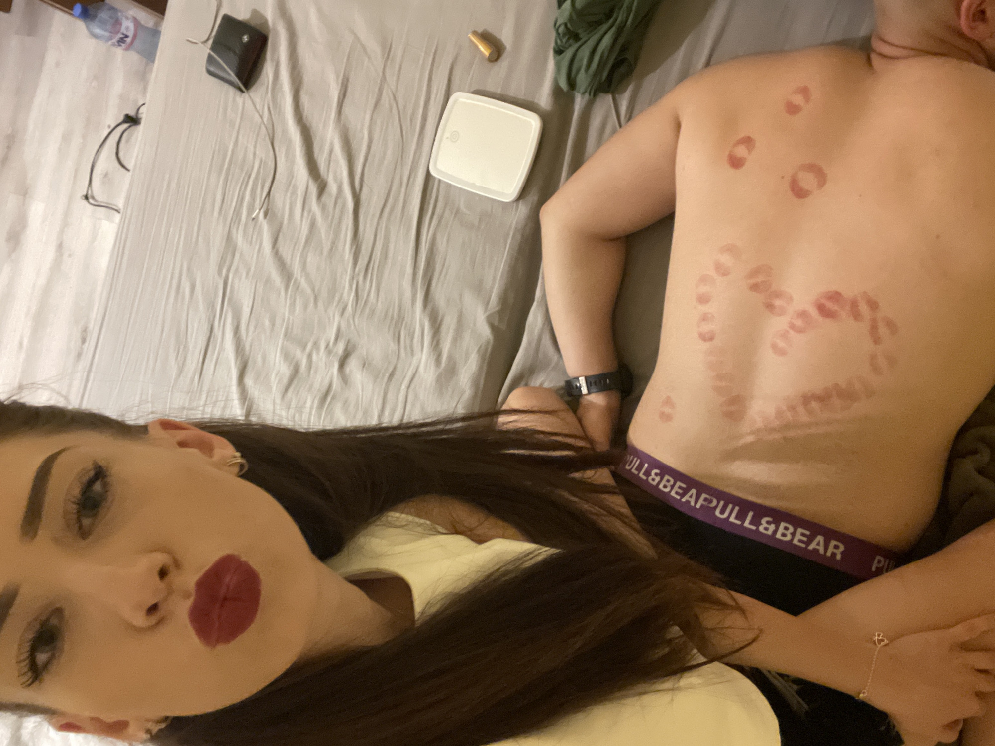 In an indoor setting, a young woman with dark hair and bold red lipstick puckers her lips for the camera, her face close to the lens. She wears a light yellow t-shirt. Next to her, a person lies on their back on a bed, their torso visible. This person's upper back and shoulder are adorned with numerous reddish marks, consistent with hickeys or love bites. The bed has rumpled gray sheets. In the background, on the bed, are various objects including a wallet, a charging cable, a white square device, a bottle of water, and a folded green cloth. The overall scene suggests an intimate moment.