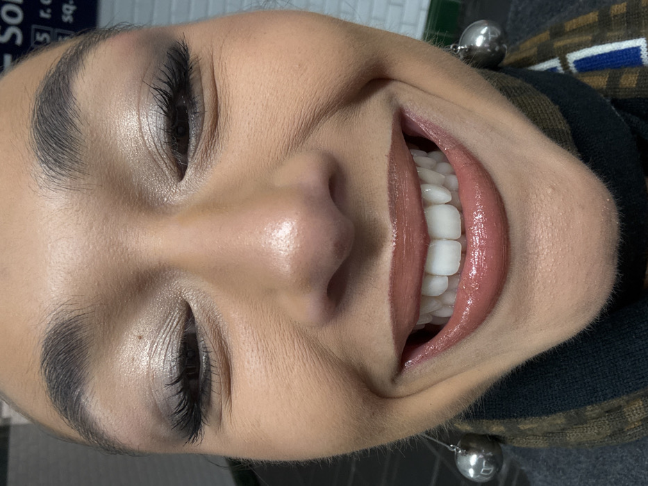 The image provides an extreme close-up, frontal portrait of a female subject smiling broadly, with eyes narrowed and cheeks raised. The subject displays a full application of makeup, including iridescent light-toned eyeshadow, defined false eyelashes, well-groomed eyebrows, and high-gloss, warm brown lipstick, revealing a full set of white, well-aligned teeth. A large, spherical, silver-toned earring is visible on the subject's left side. The subject is wearing a dark, possibly high-necked garment and a scarf featuring a brown and black patterned design, with discernible blue and white elements. The background is blurred but reveals details consistent with a Paris Métro station interior, specifically a partial blue sign with white text reading "SO", "5 r. des", and "sq. G.", positioned above a white tiled wall with a distinct horizontal green stripe.