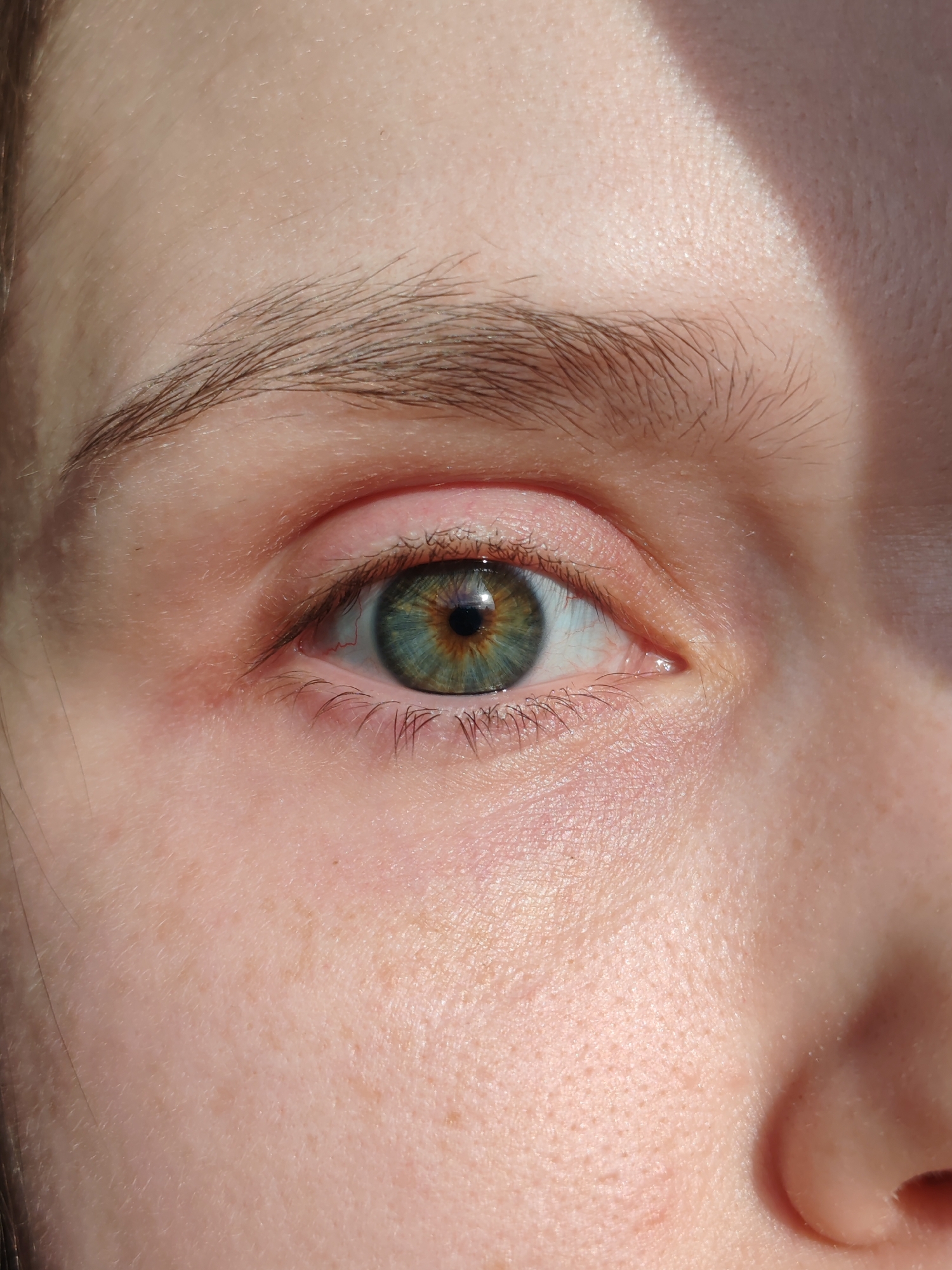 A close-up, brightly lit portrait captures a human eye and surrounding facial features, likely belonging to a young adult. The eye is hazel, displaying central heterochromia with a distinct amber-brown ring around the dark, round pupil, transitioning to a vibrant green and blue-green hue in the outer iris. The pupil reflects a bright, direct light source.
Fine, dark eyelashes frame the eye, and a natural, dark brown eyebrow arches above it. The surrounding fair skin shows visible pores, subtle freckles, and fine facial hair. Delicate red veins are visible in the white sclera, particularly towards the inner corner.
The lighting is strong, direct sunlight, creating a sharp diagonal shadow across the upper right portion of the face, indicating a clear daytime setting. This harsh illumination accentuates the texture of the skin. No specific activity is depicted beyond a direct, neutral gaze. No visible text or distinct objects are present other than the detailed facial features. The image is contextualized as being from Ust-Ilimsk, Russia.