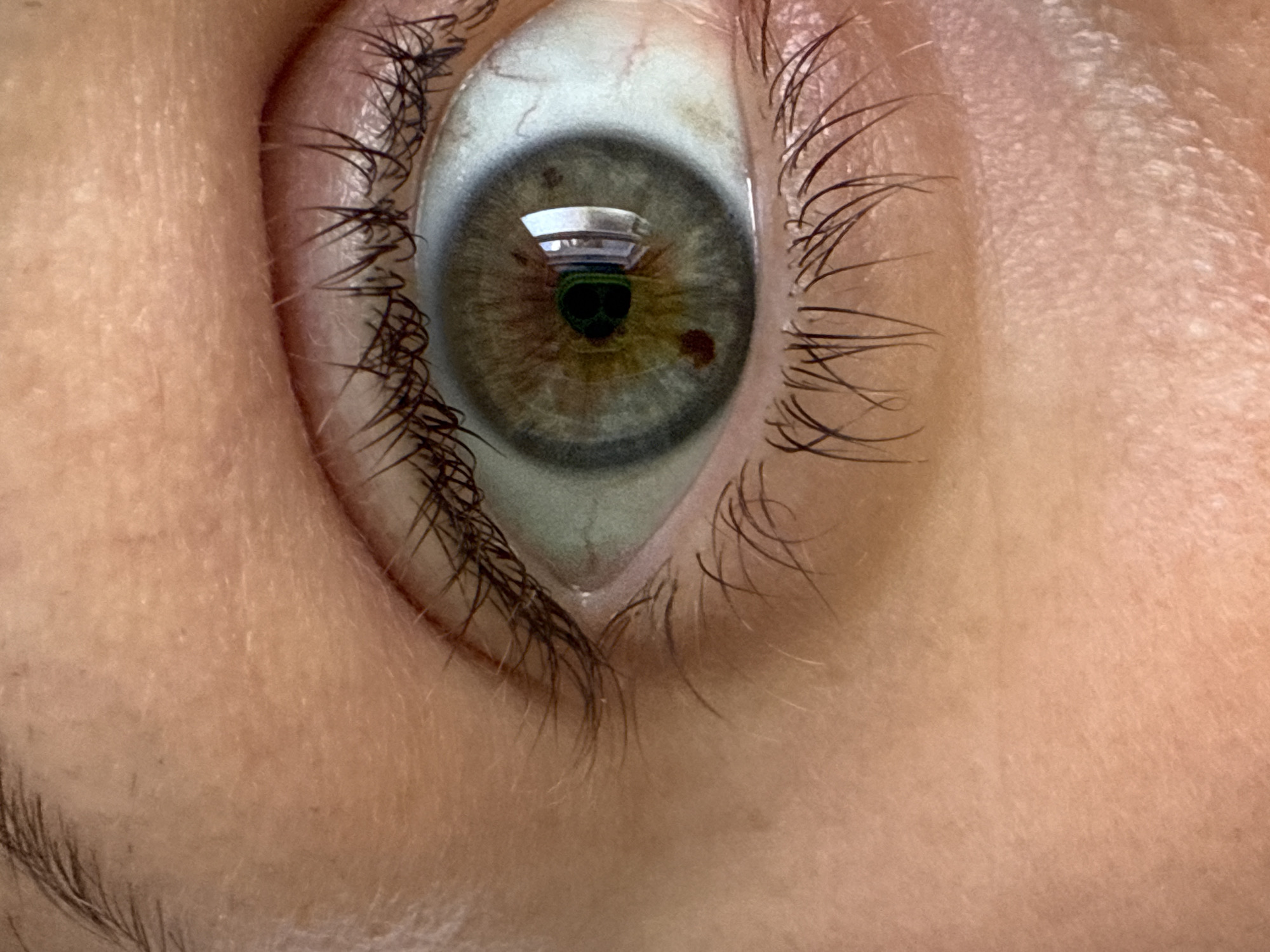 The image is a close-up shot of a human eye. The iris is a mix of green and brown, with a darker brown spot visible on the lower part of the iris. The pupil is black and round. The whites of the eye are visible and appear healthy. Eyelashes frame the eye, and the skin around the eye shows some texture. The lighting in the image highlights the details of the eye and surrounding skin. There is a reflection in the eye, suggesting the presence of windows or a brightly lit environment, but the origin of the reflection is not definitively identifiable. No specific location in Tvarditsa, Bulgaria, can be determined from this image.