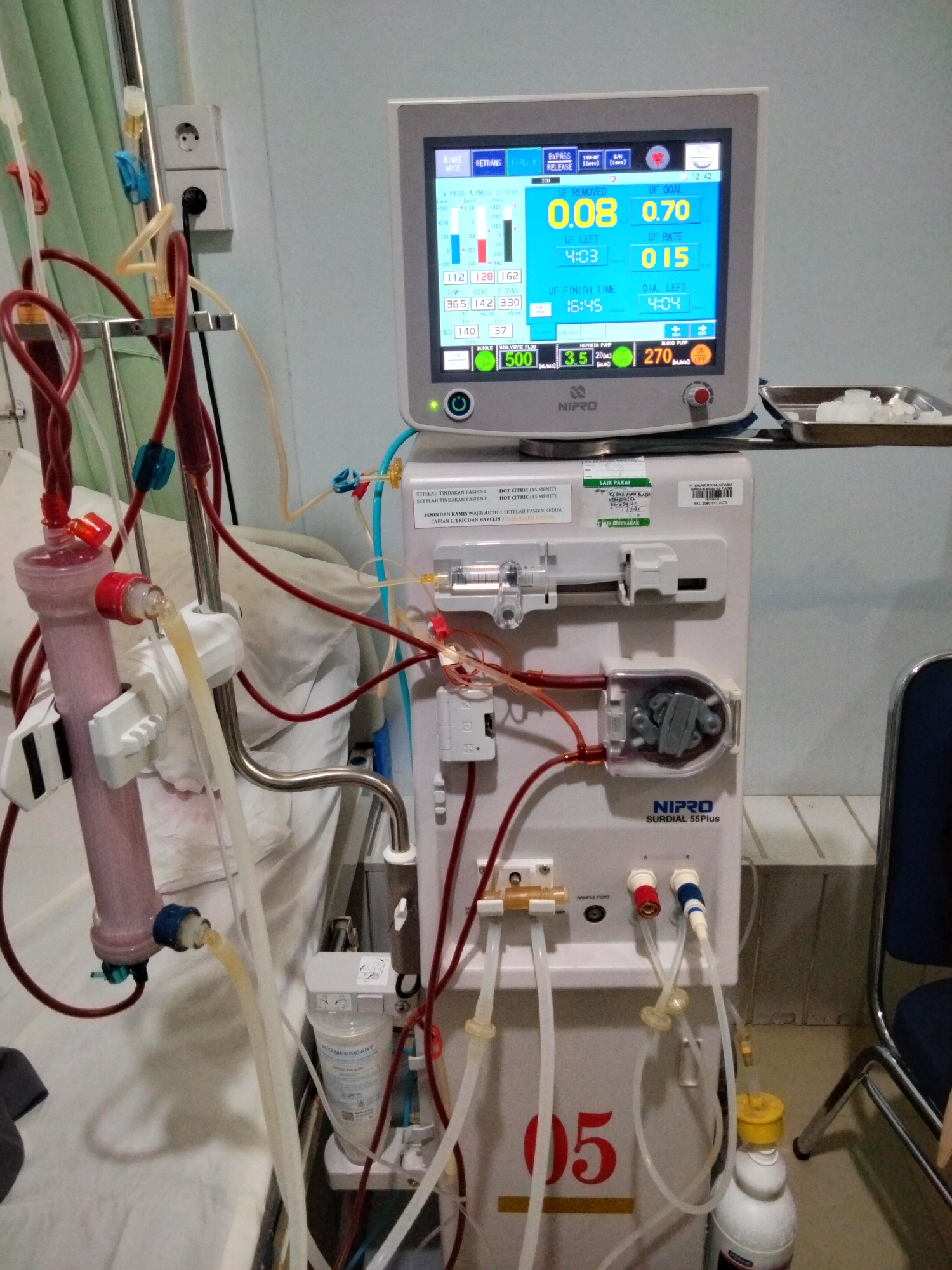 The image depicts a dialysis machine in what appears to be a hospital room. The machine, a NIPRO SURDIAL 55Plus, is the central focus, with its screen displaying various readouts including UF COAL, UF REMOVED, UF LEFT, UF RATE, UF FINISH TIME, and DIA. LEFT. Several tubes and connectors are attached to the machine, some carrying reddish fluid. A large pinkish filter is visible on the left side, connected to a tube. A white filter is also attached to a tube lower down on the machine. The machine has the number "05" prominently displayed on its lower section. In the background, a white bed with linens is partially visible, suggesting a patient care setting. A green curtain hangs on the left, and electrical outlets are mounted on the wall behind the machine. The scene is illuminated by artificial light. There are no people visible in the image. The presence of a dialysis machine strongly suggests a medical facility, likely a hospital or dialysis center. The text on the machine and labels, such as "NIPRO," and Indonesian text on labels, like "LAIK PAKAI" and "SETELAH TINDAKAN PASIEN," indicate it is operating in Indonesia. While the specific location in Lhokseumawe, Indonesia cannot be definitively determined from the image alone, it is likely a healthcare establishment within that city, possibly a hospital like PT Arun Medical Center which is known to operate in Lhokseumawe and may have such equipment.
