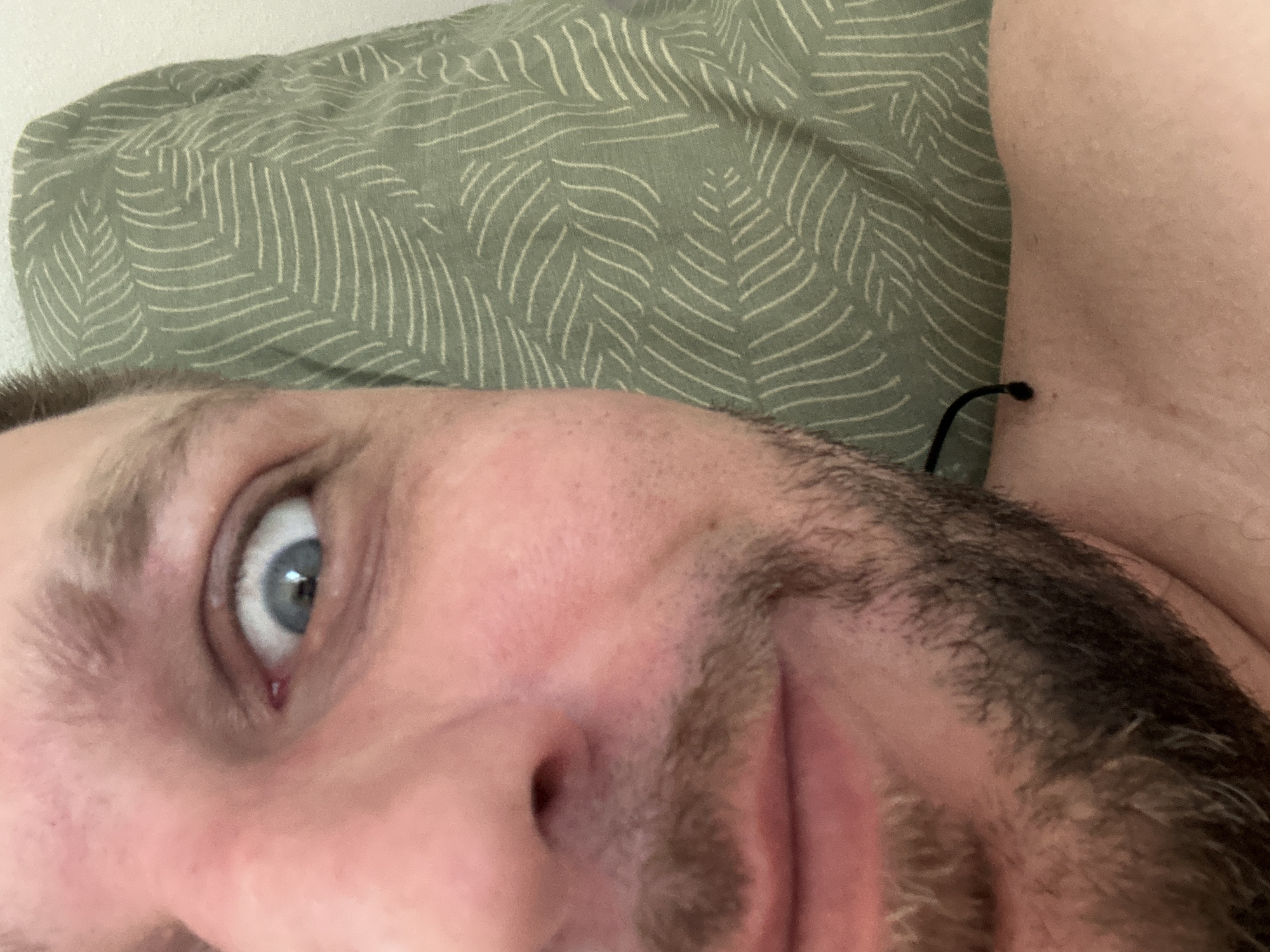 A close-up, extreme-angle, selfie-style photograph shows the left side of a person's face, including their eye, nose, mouth, and beard. The person's left eye is wide open, with a blue iris. Their skin is fair, with some visible pores and redness. They have a light brown beard and mustache. The person is lying down, and a pillow with a green leaf pattern is visible behind their head. The image is likely taken in a bedroom environment within Zvezdara Urban Municipality, Serbia, given the context provided.