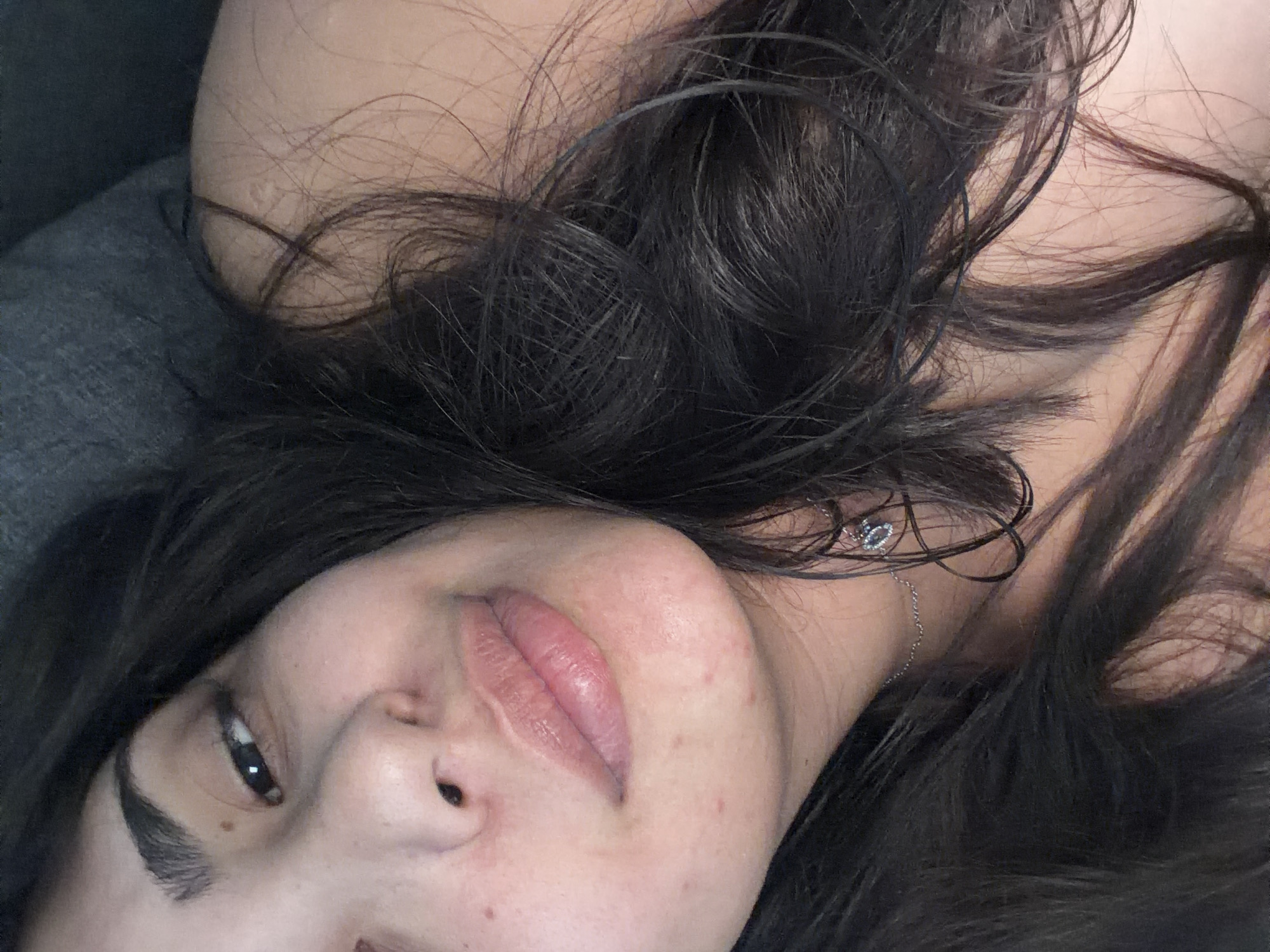 The image is a close-up portrait of a young woman with dark hair, lying down. She has fair skin with some visible blemishes and redness. Her lips are full and slightly parted. She is wearing a delicate silver necklace with a small charm. The background is dark and appears to be a soft surface, possibly fabric. There are no discernible elements of the city of Duisburg, Germany in this image.