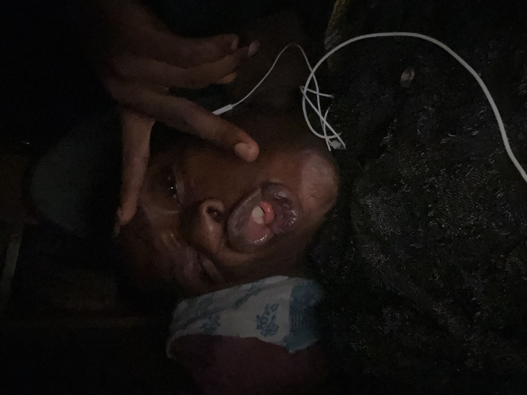 The image depicts a person lying down, possibly in a dark room or low-lit environment. A hand with dark skin is positioned near the person's face. White earbuds are also visible, tangled near the person's head. The person's mouth is open. A patterned cloth covers the lower portion of their face or neck. The location is Unknown, Unknown.