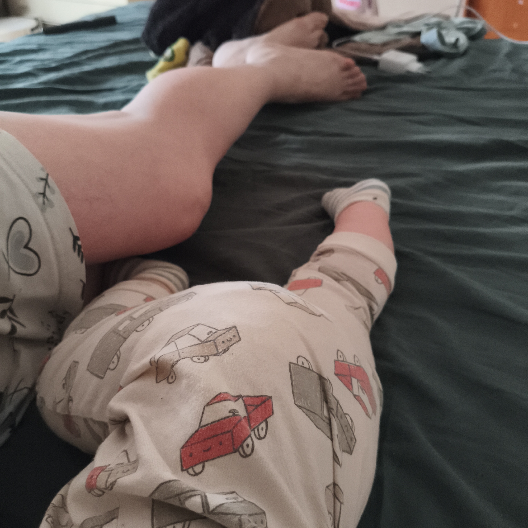 A low-angle shot presents a scene on a dark green bed. The primary focus is on a baby, dressed in light-colored pajamas patterned with drawings of vehicles. The baby is lying on its stomach with its legs extended towards the foreground, one foot is covered in a gray and white striped sock. Adjacent to the baby's legs, an adult lies with a leg extending to the left, clad in pajamas patterned with hearts and branches. The adult's bare foot is also visible, near a black object and other indistinct items on the bed. The location of the scene is not specified.