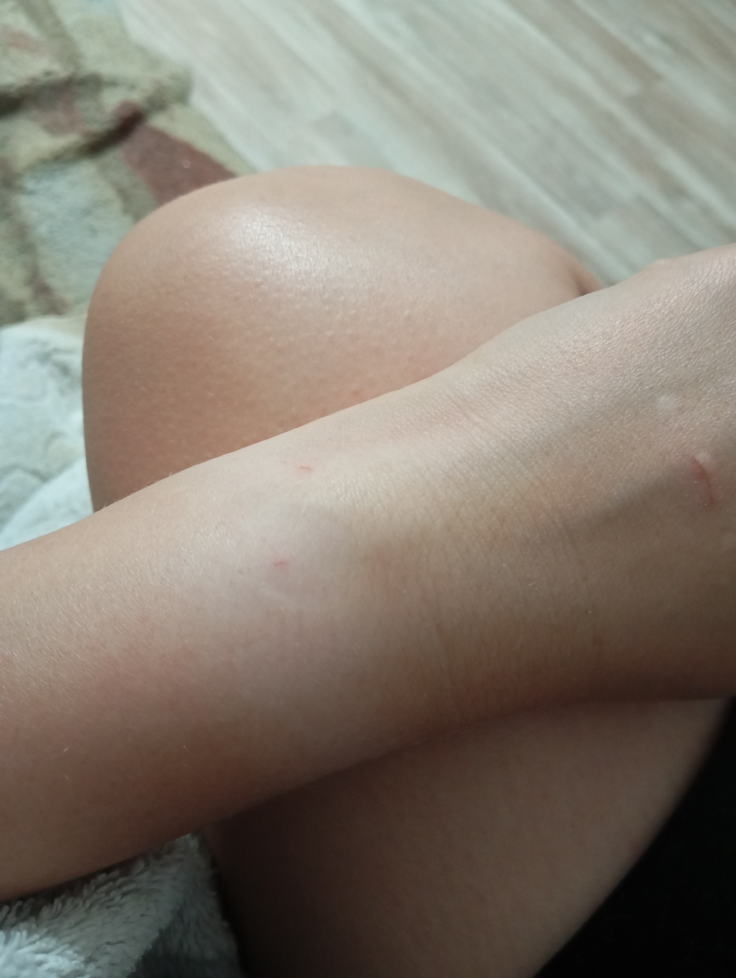 The image shows a close-up view of a person's arm resting on their leg. The skin appears fair and smooth with some minor redness, possibly indicating scratches or irritation. The arm is bent, with the forearm crossing over the thigh. The background is softly blurred, showing a striped carpet on the left and a wooden floor on the right. There are no discernible features that would allow for identification of the specific location within Orenburg, Russia, or any specific actions or interactions. The overall impression is a casual, indoor setting.