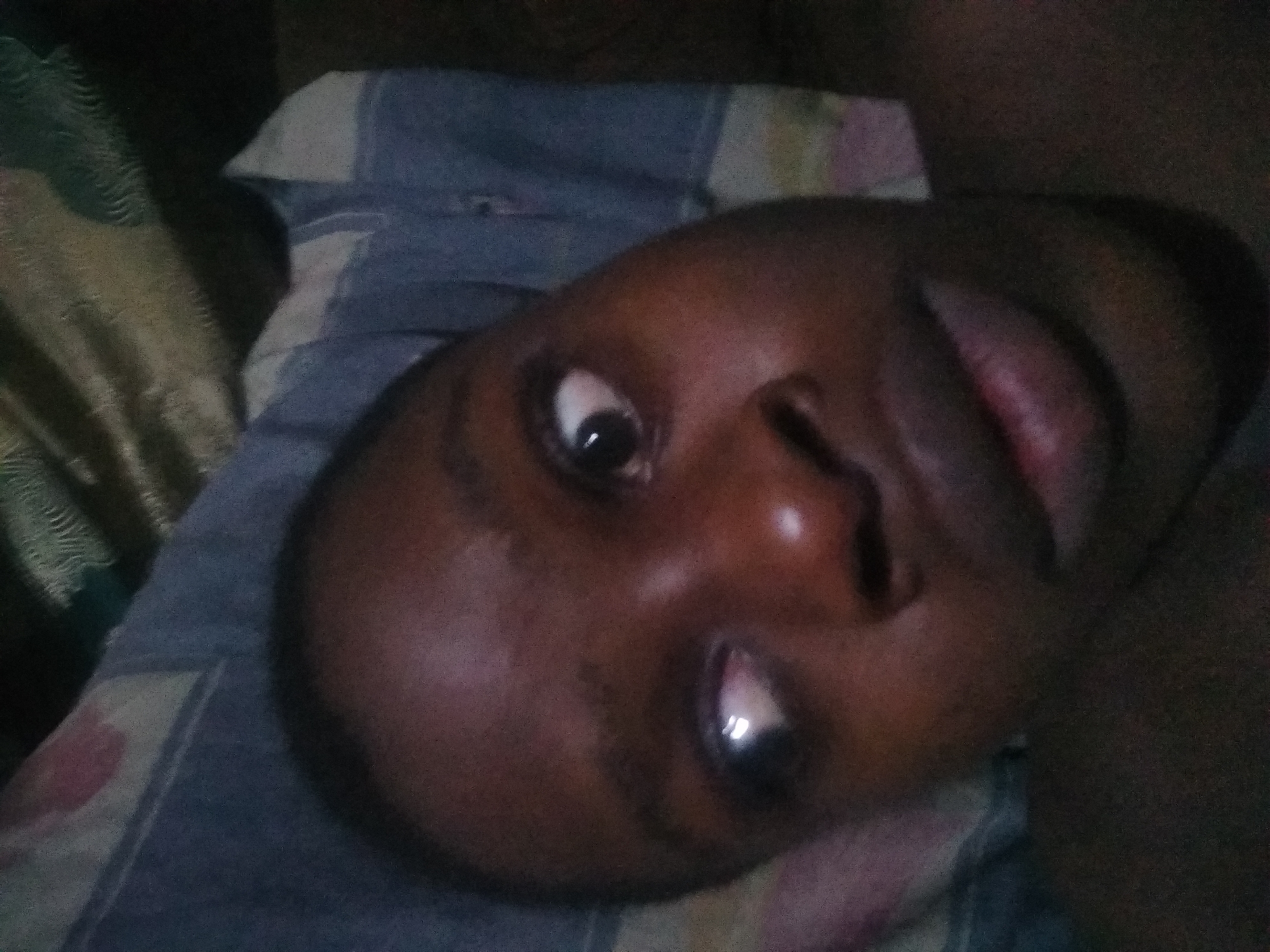 A person with dark skin is lying on their back on a bed. The person's face is turned towards the camera. The sheets have a blue and gray striped pattern. The location is Shangisha, Nigeria.